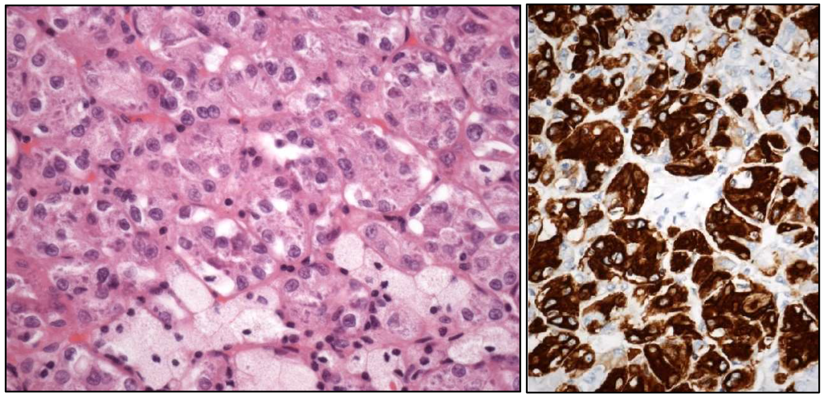 Cancers 17 01173 g002