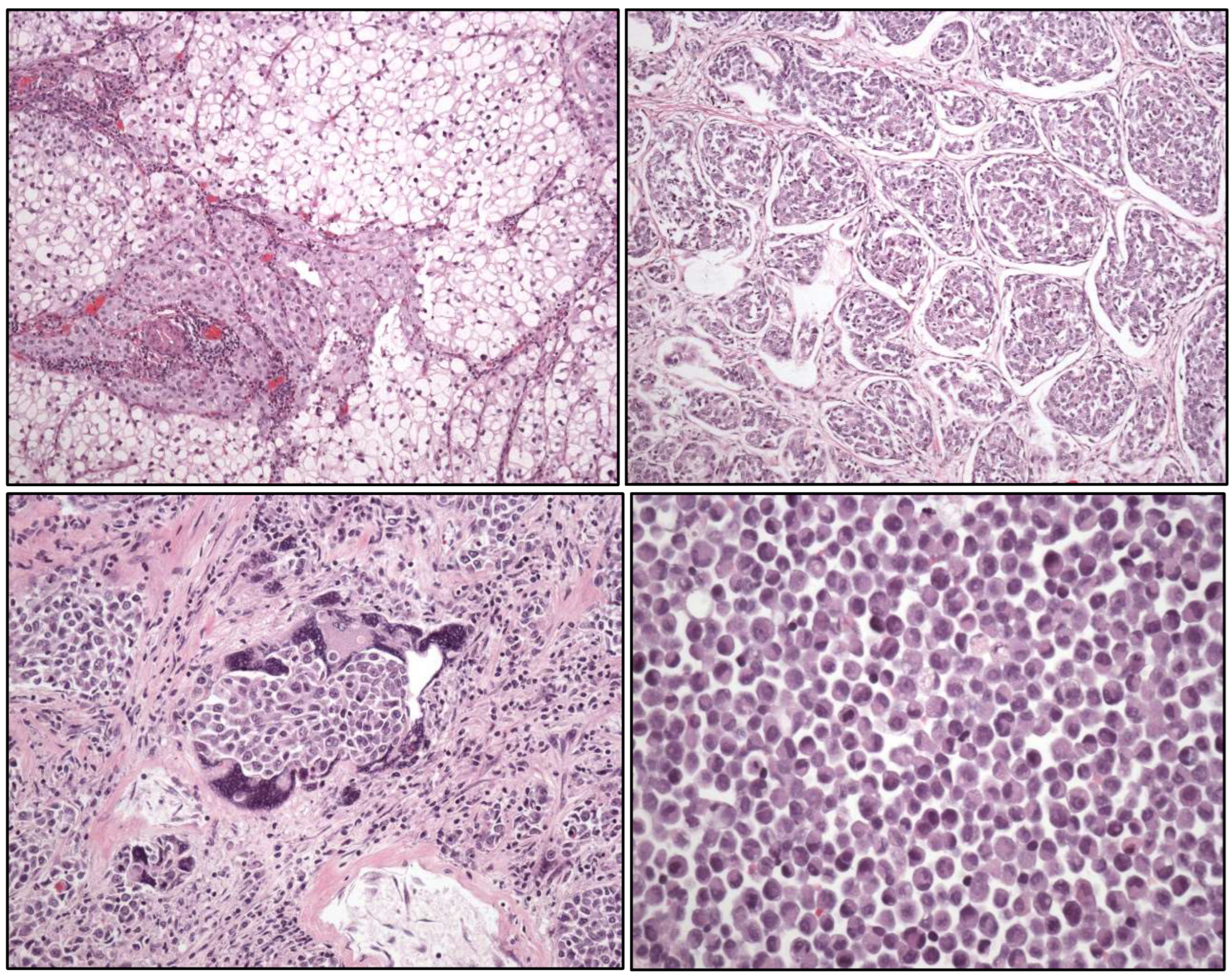 Cancers 17 01173 g003