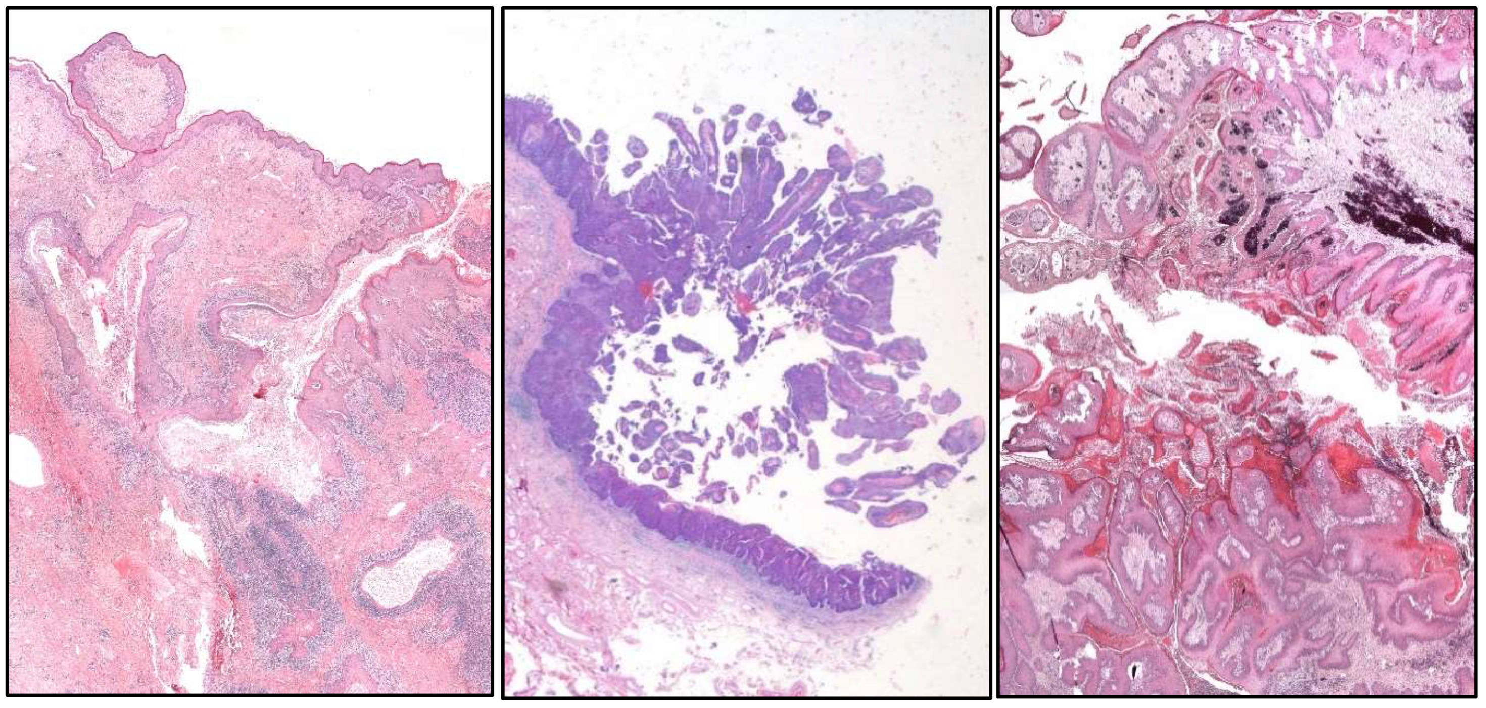 Cancers 17 01173 g005