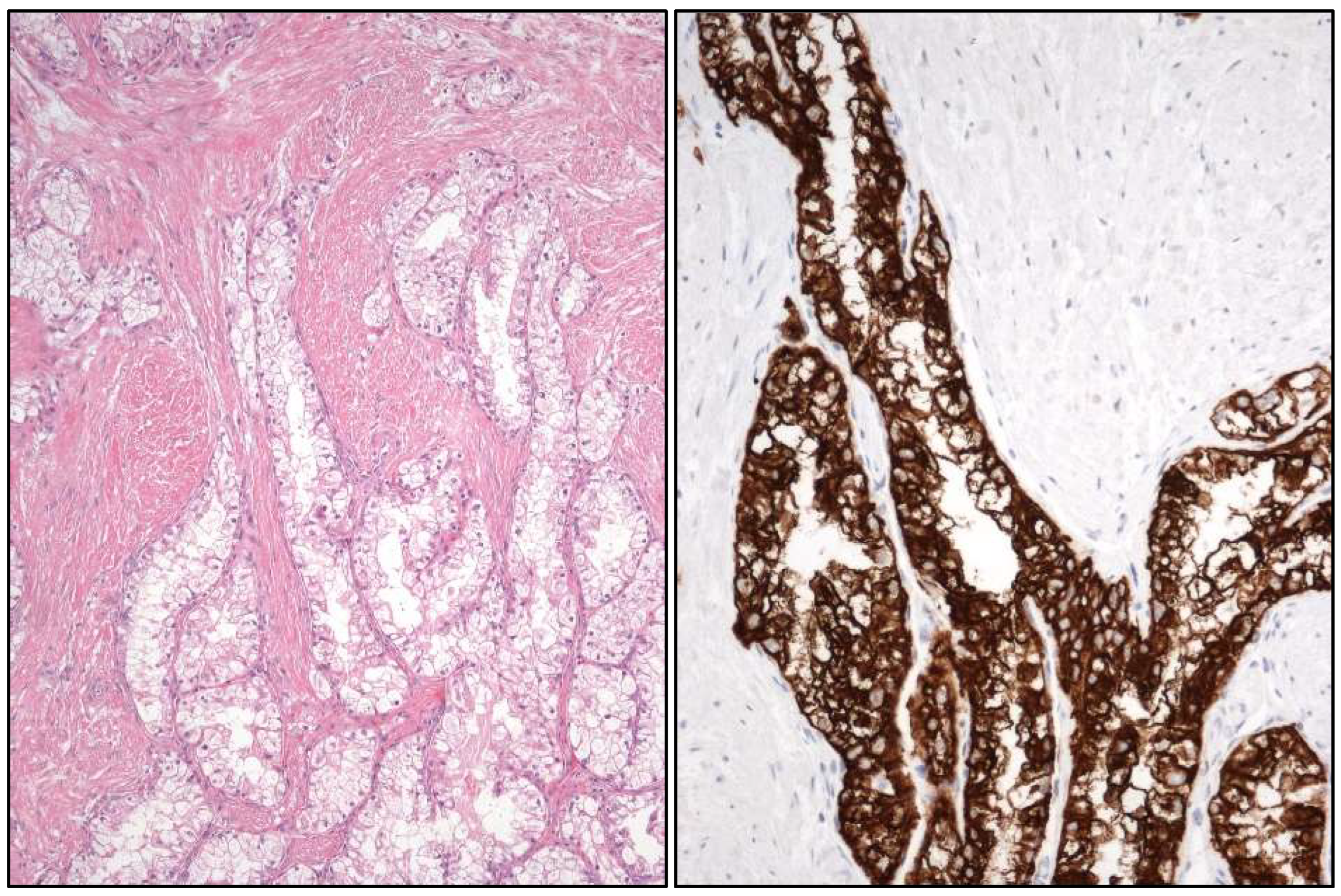 Cancers 17 01173 g006