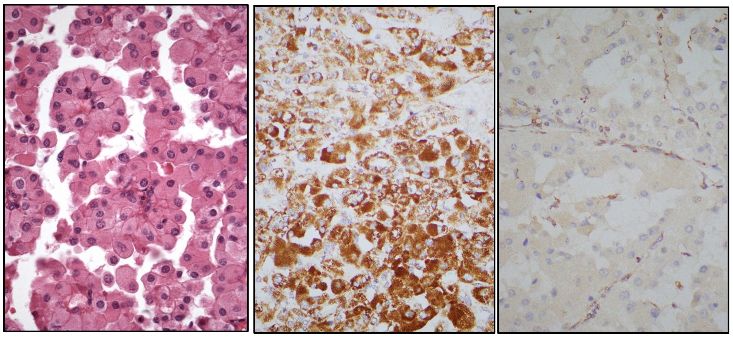 Cancers 17 01173 g008