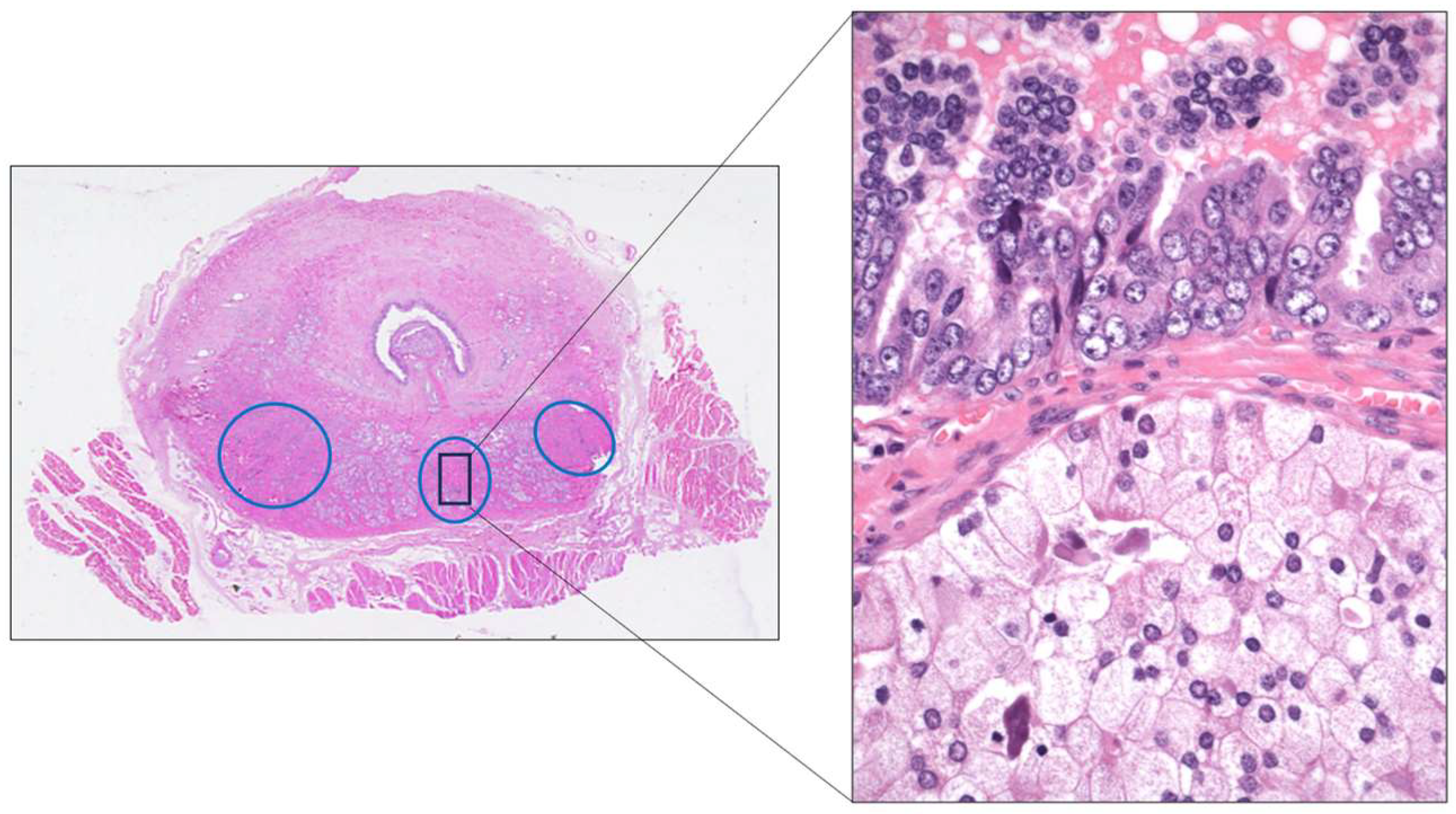 Cancers 17 01173 g009