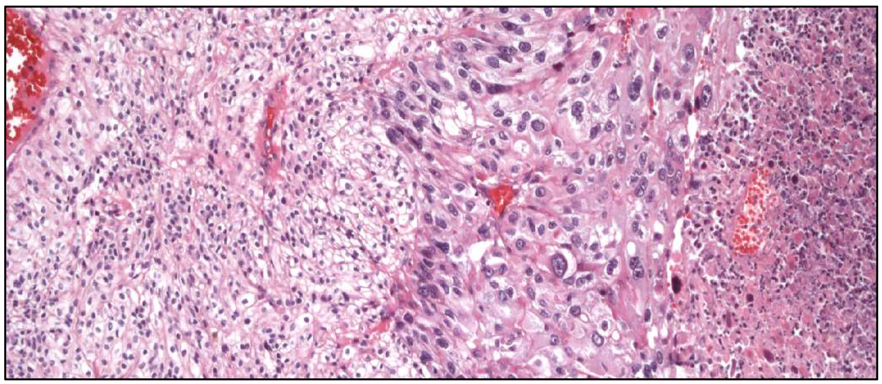 Cancers 17 01173 g012