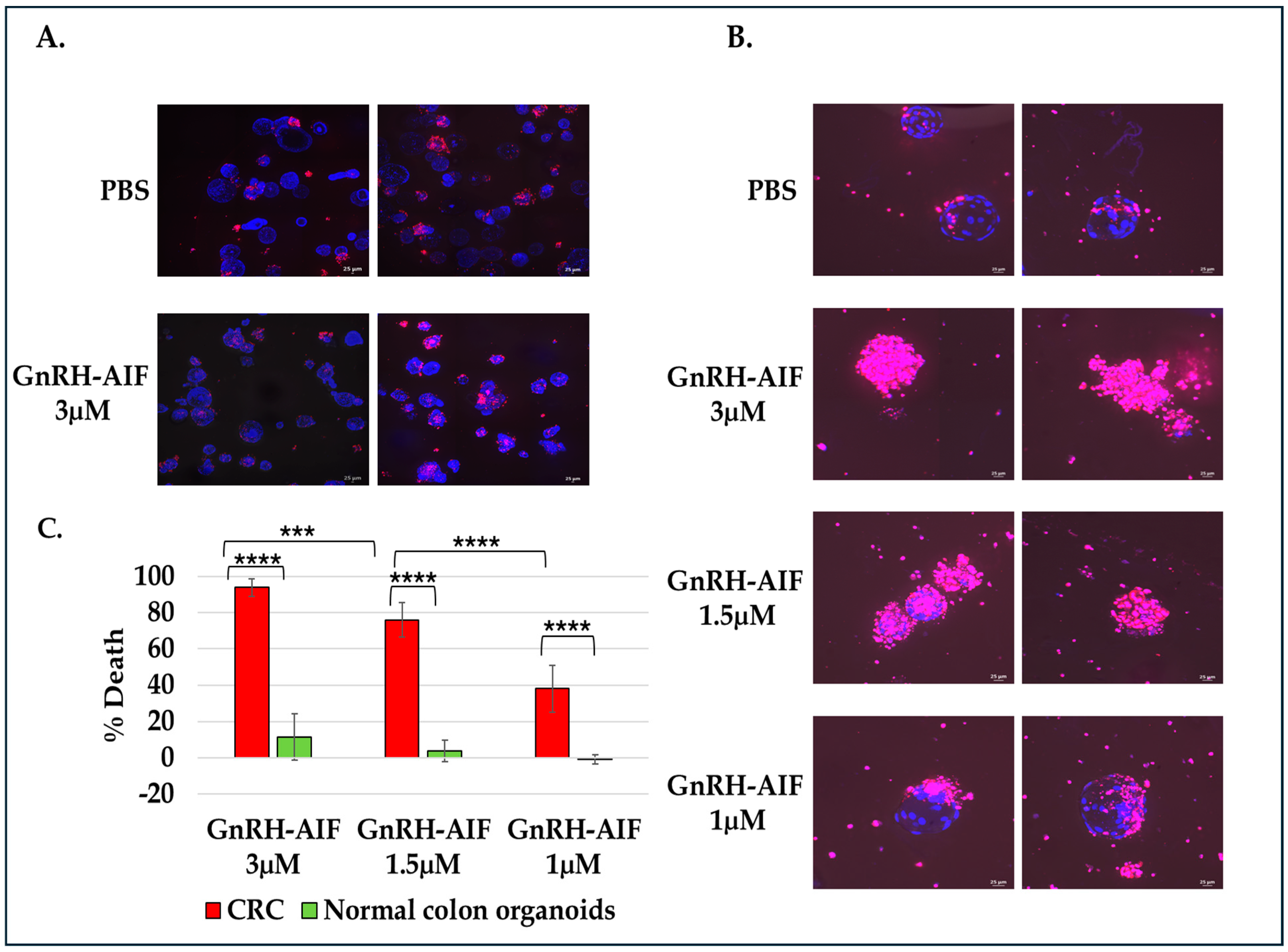 Cancers 17 01179 g009
