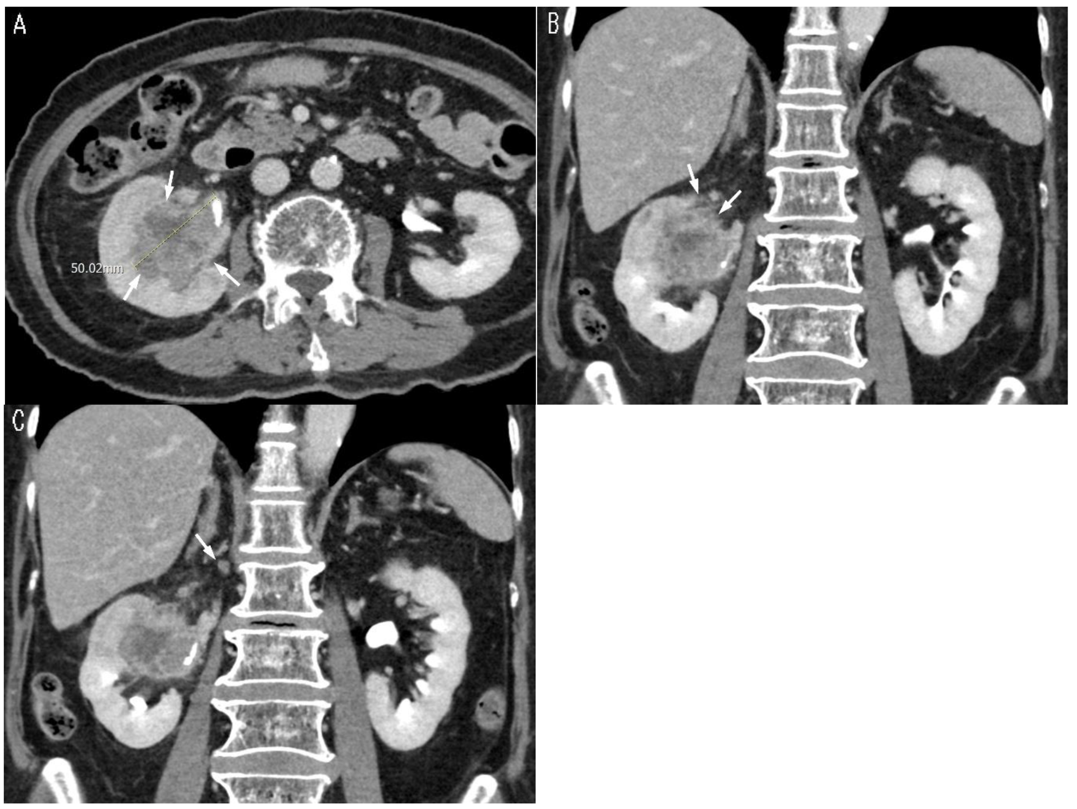 Cancers 17 01180 g003