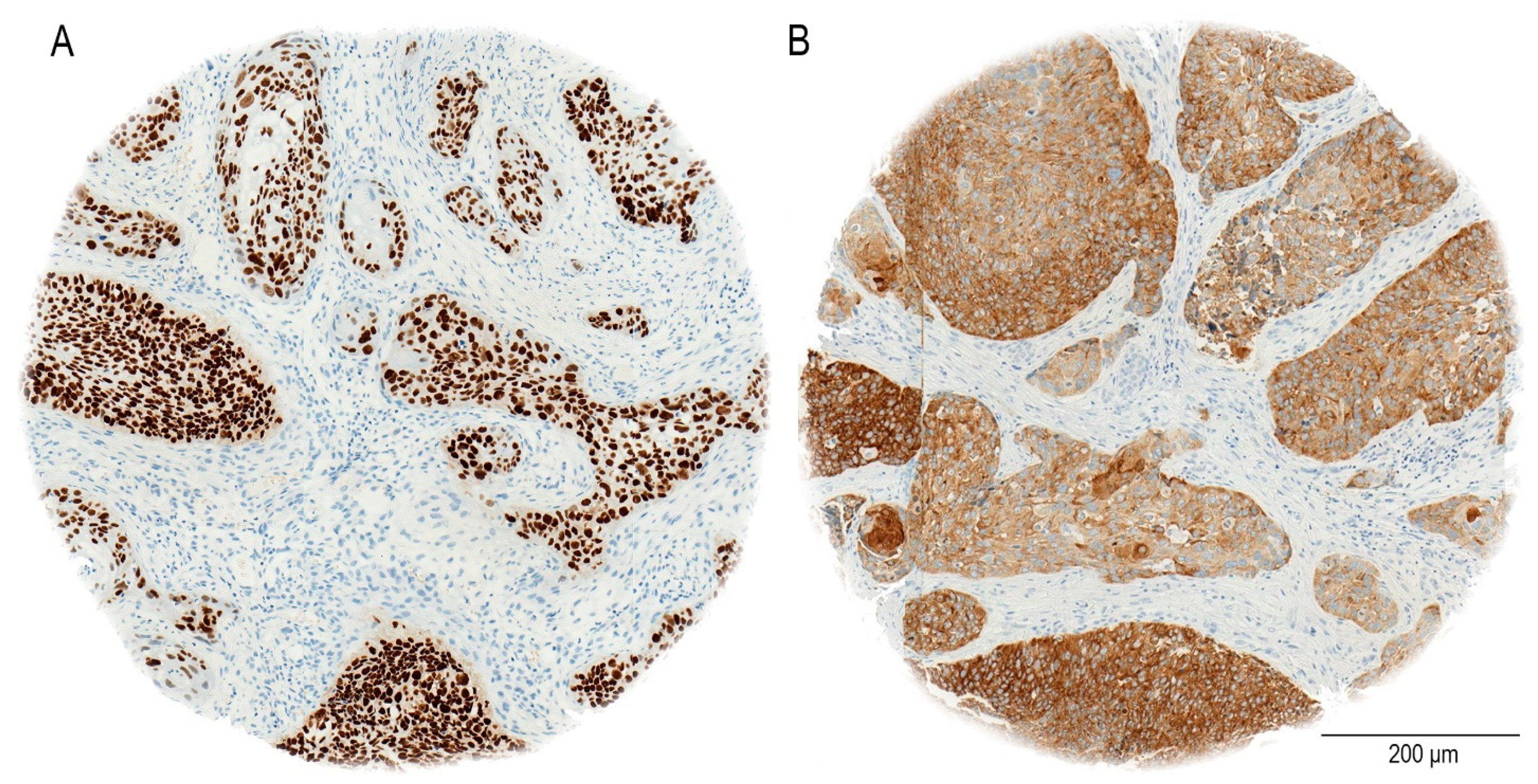 Cancers 17 01181 g002