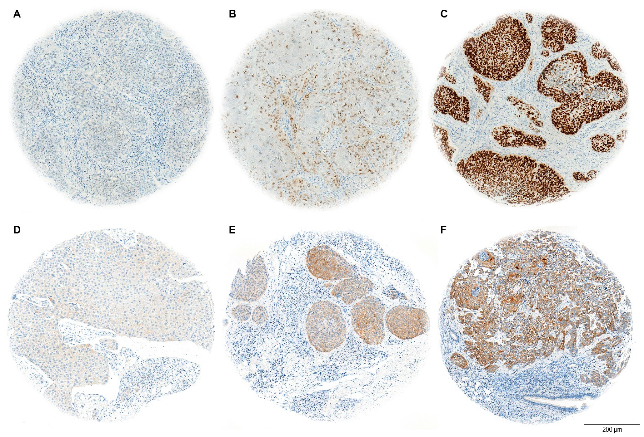 Cancers 17 01181 g003