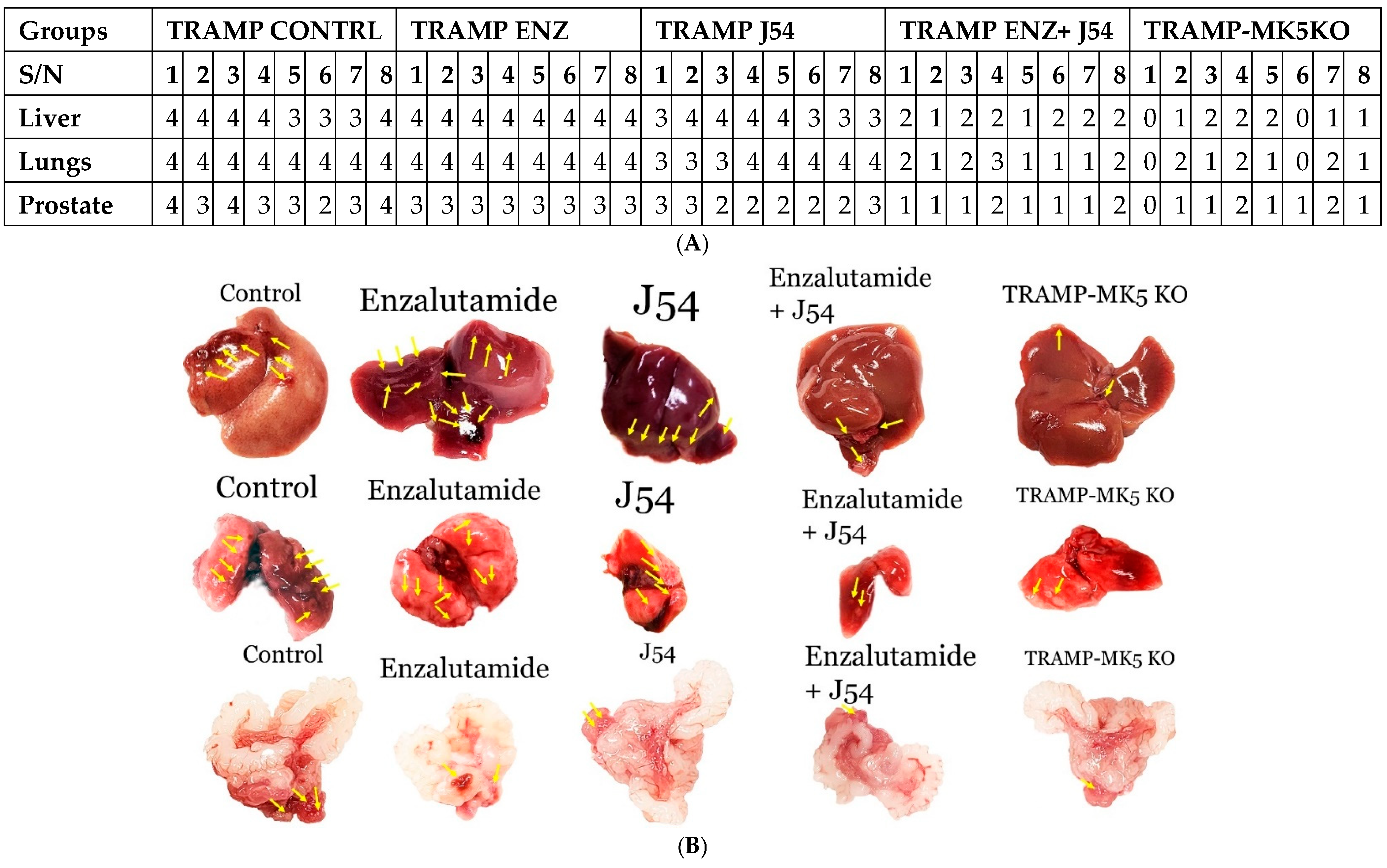 Cancers 17 01187 g004