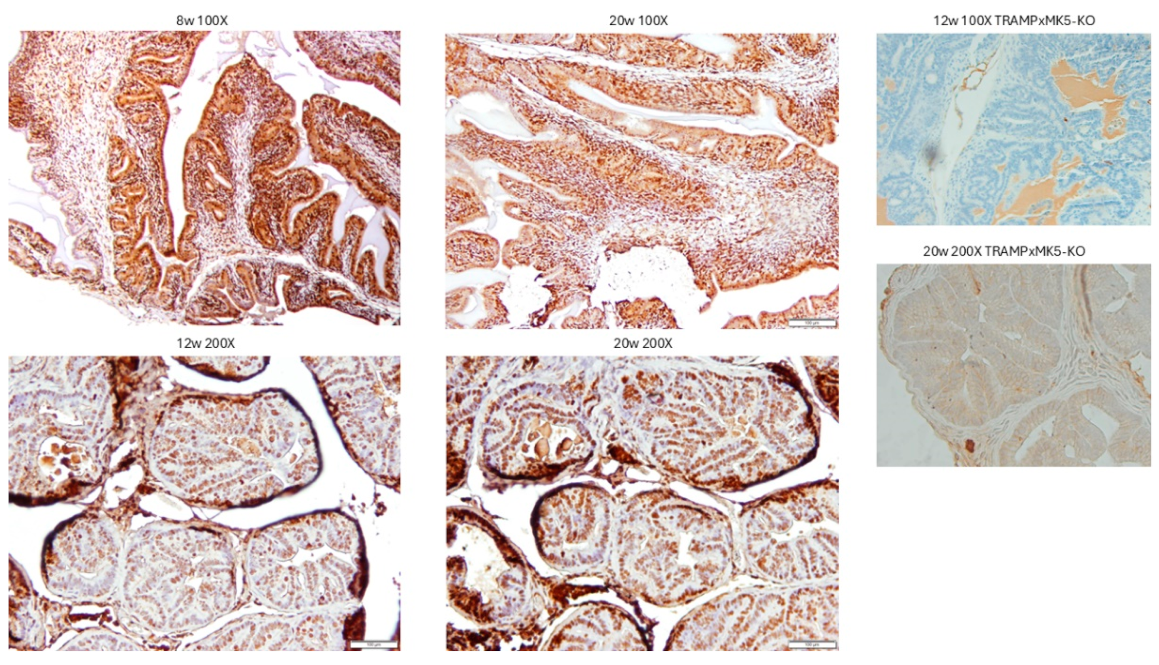 Cancers 17 01187 g005