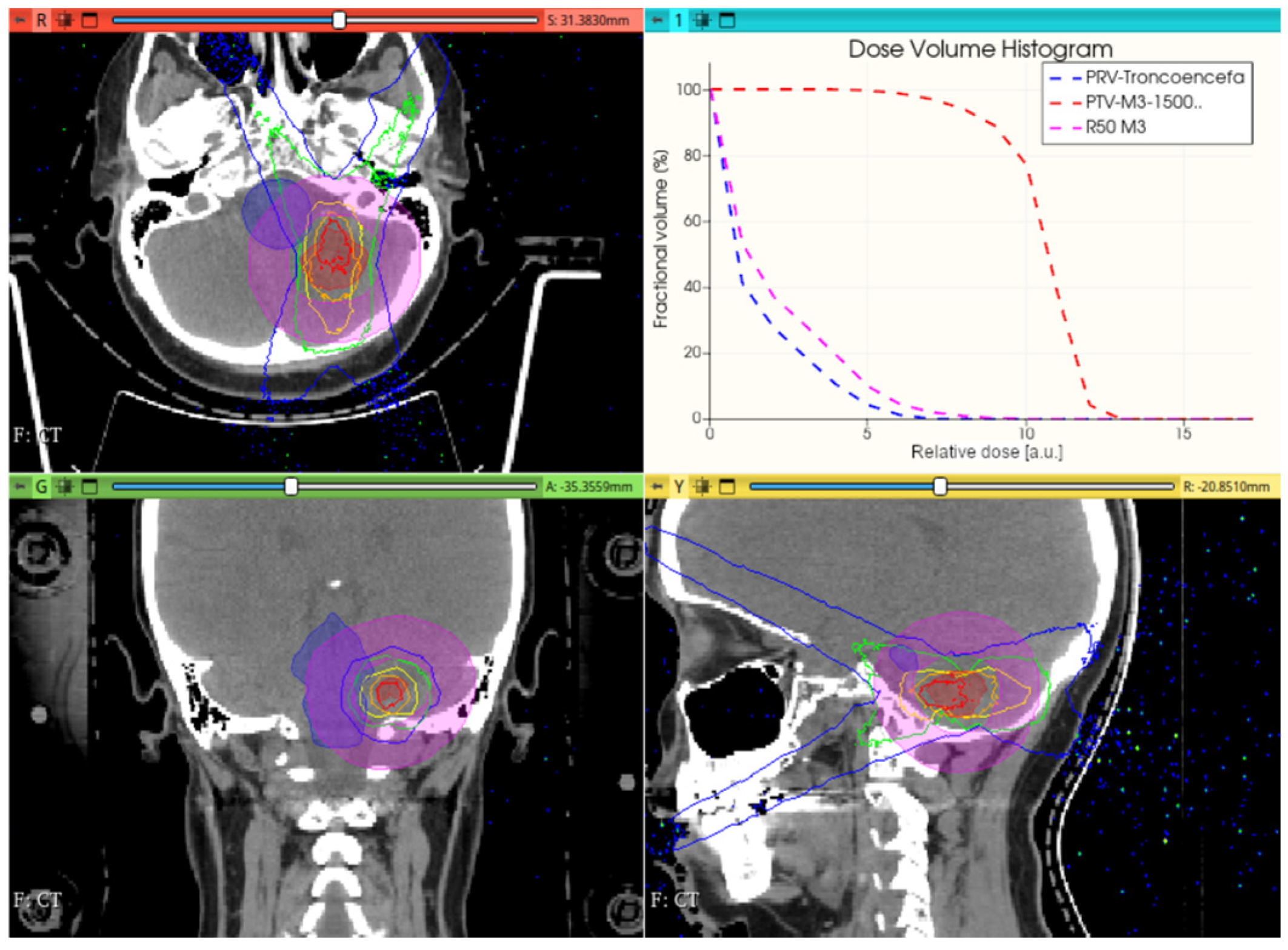 Cancers 17 01189 g012