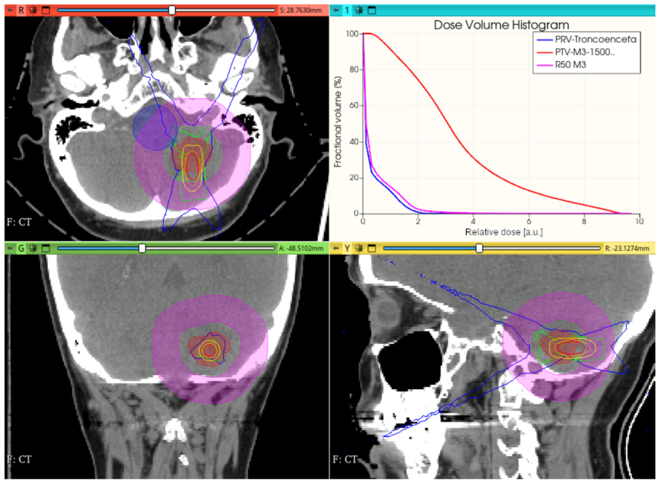 Cancers 17 01189 g013