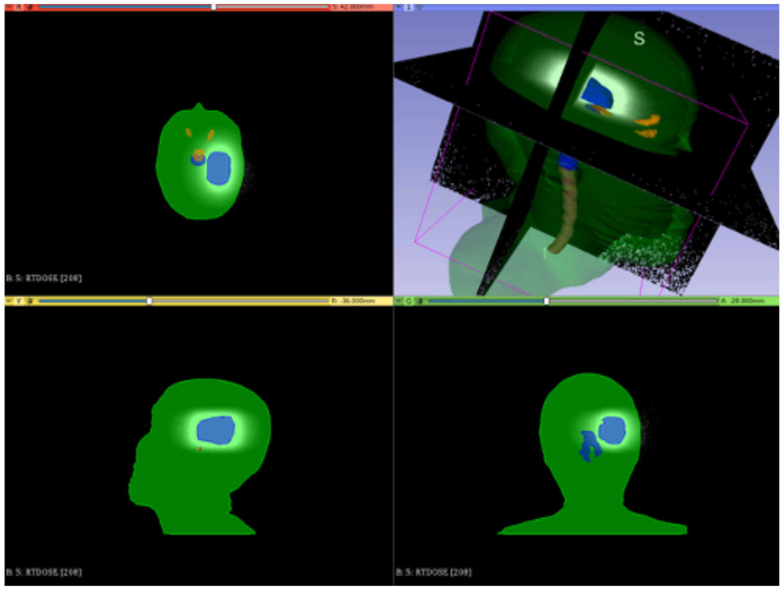 Cancers 17 01189 g014