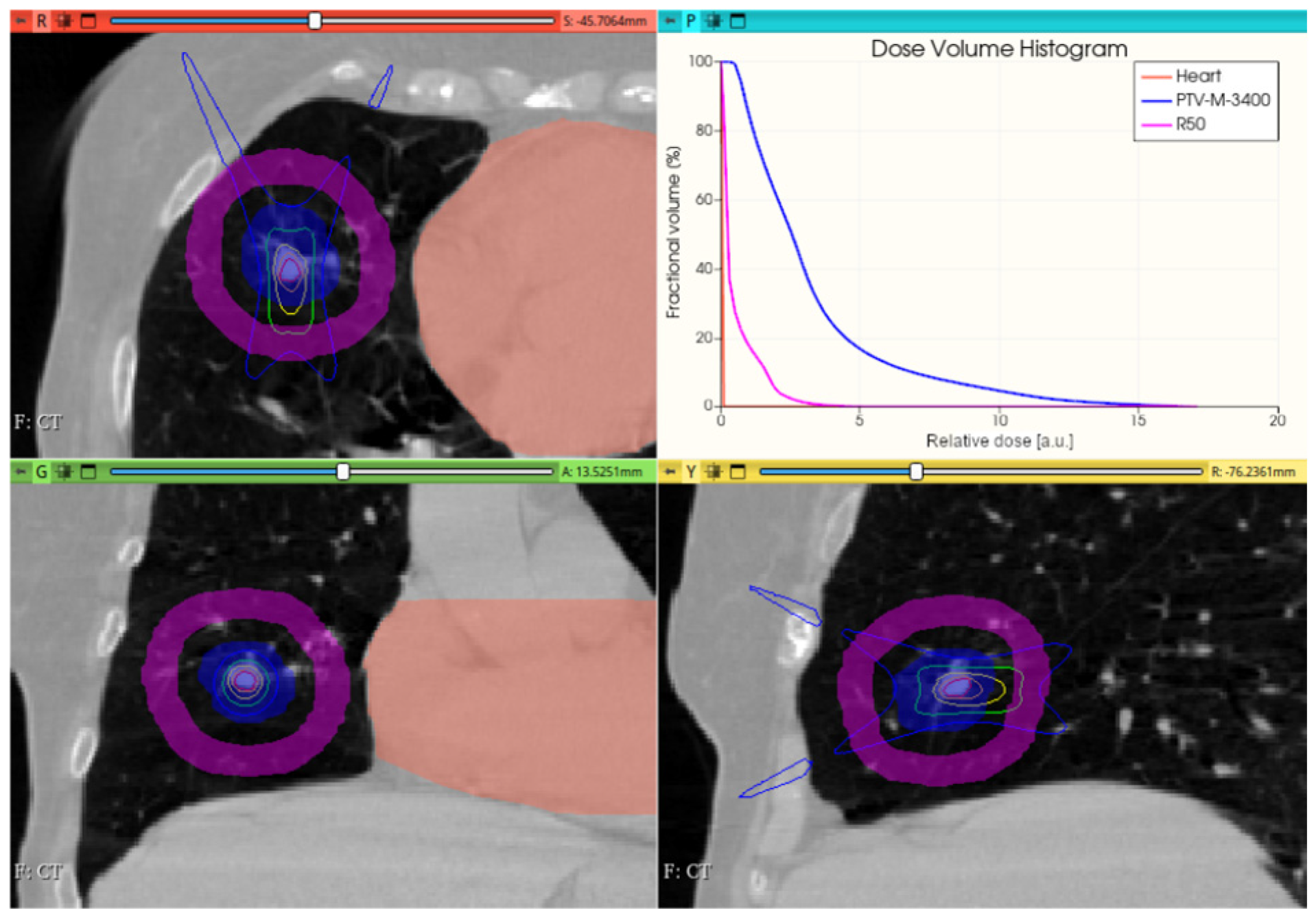Cancers 17 01189 g015