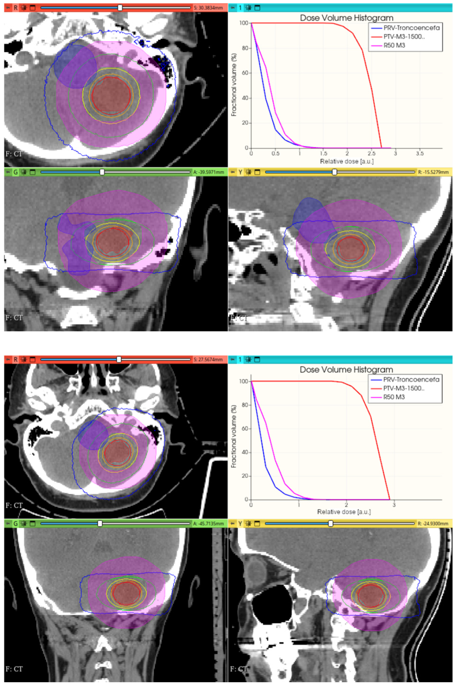 Cancers 17 01189 g016