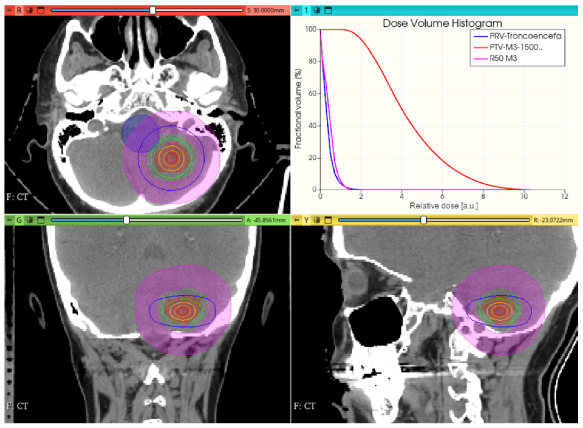 Cancers 17 01189 g017