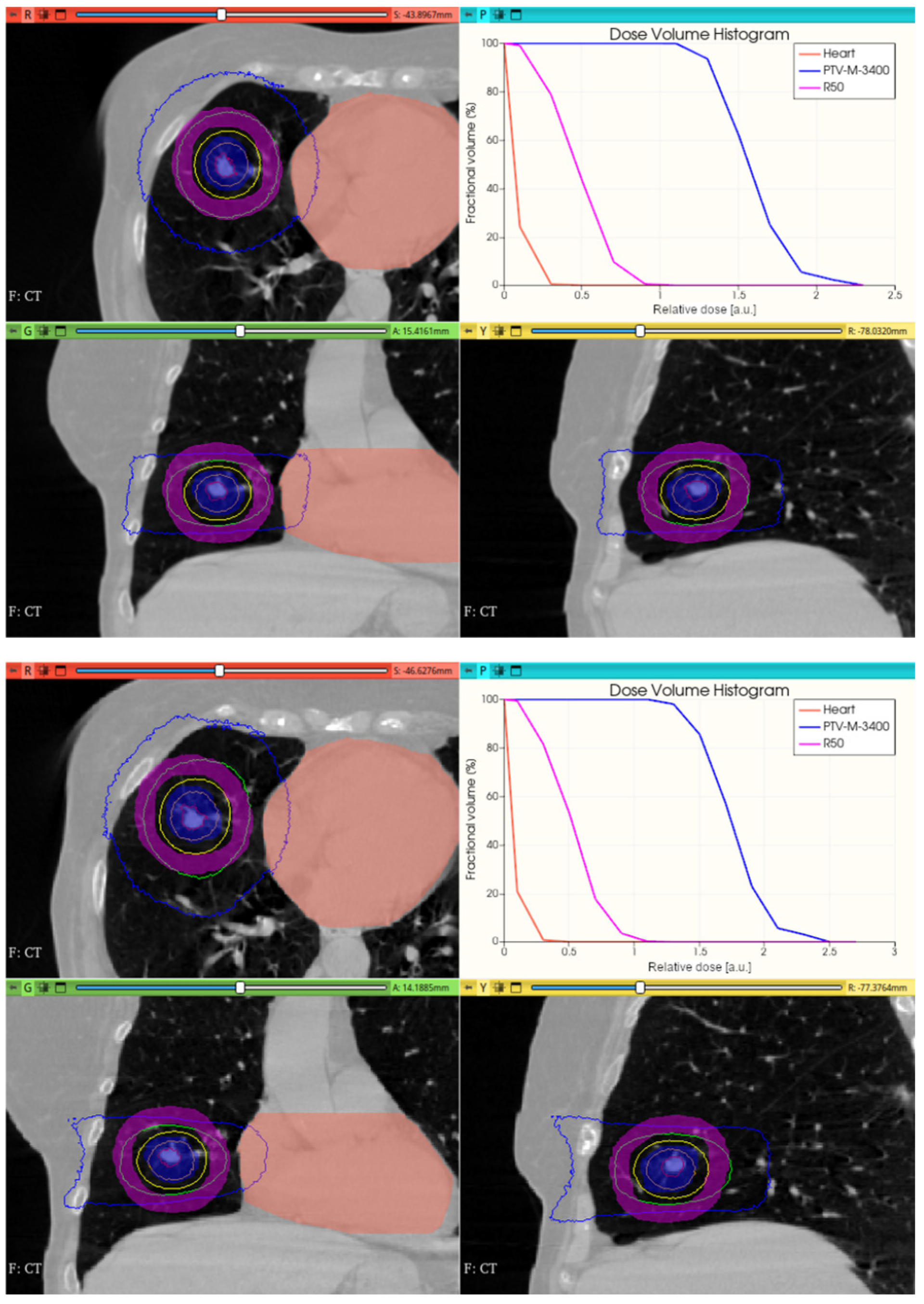 Cancers 17 01189 g018