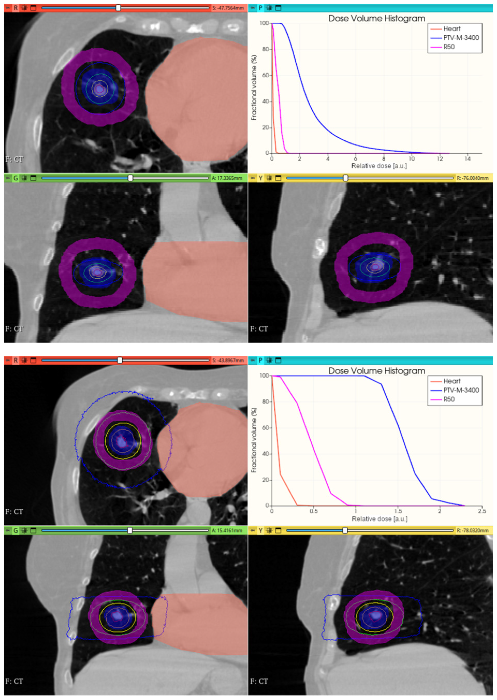 Cancers 17 01189 g019