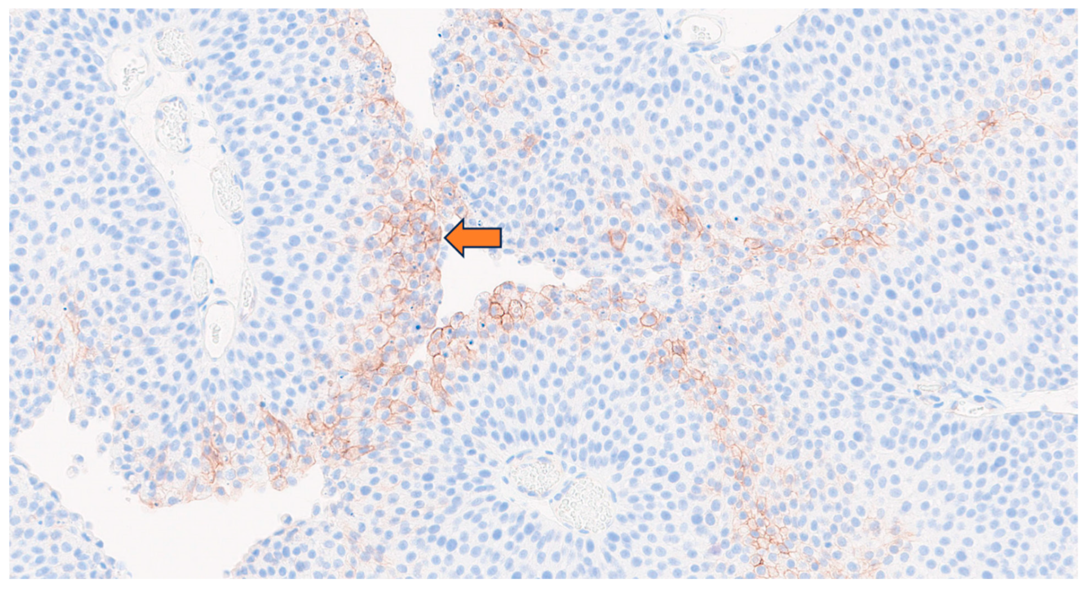 Cancers 17 01190 g004 Cancers 17 01190 g004