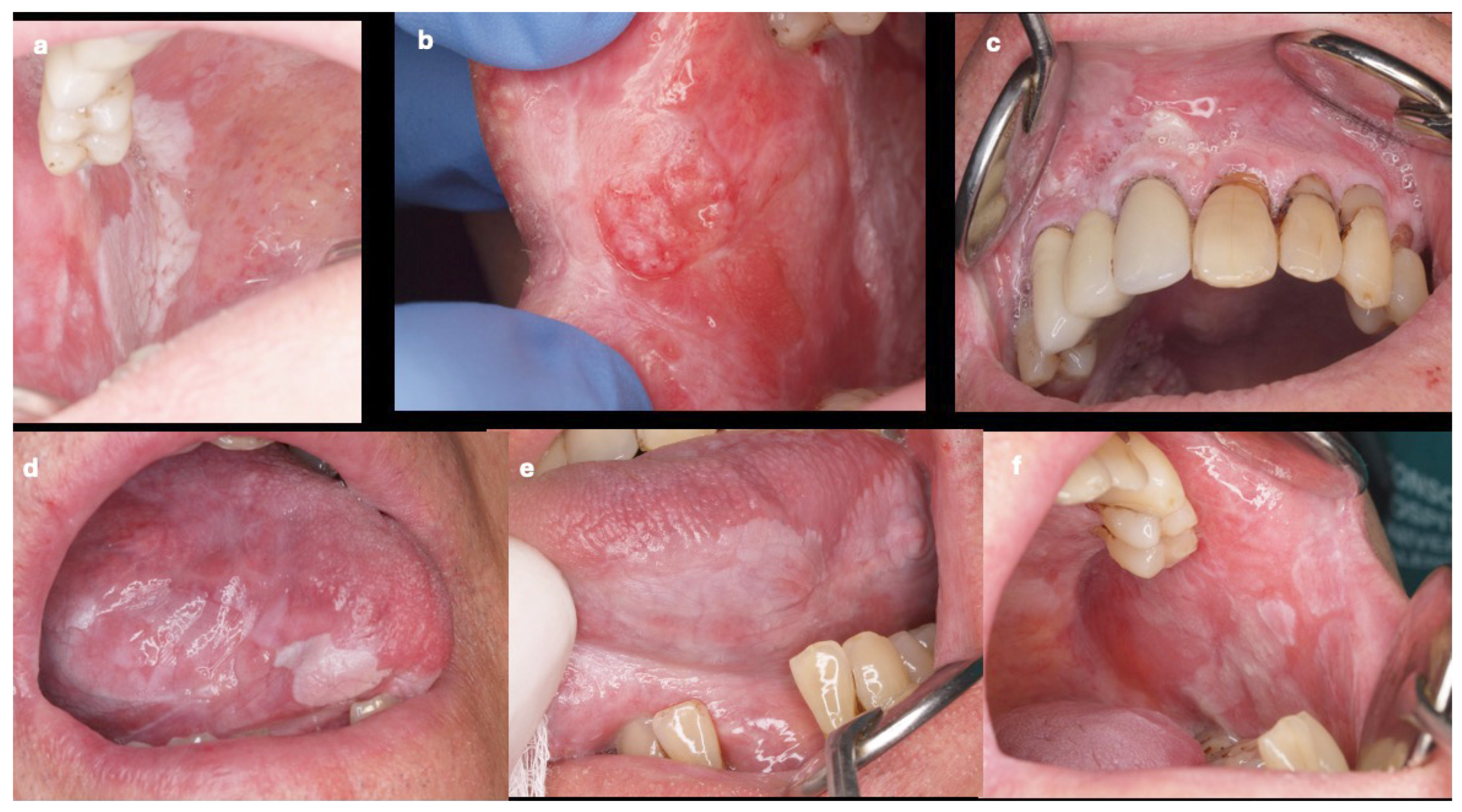 Cancers 17 01199 g001