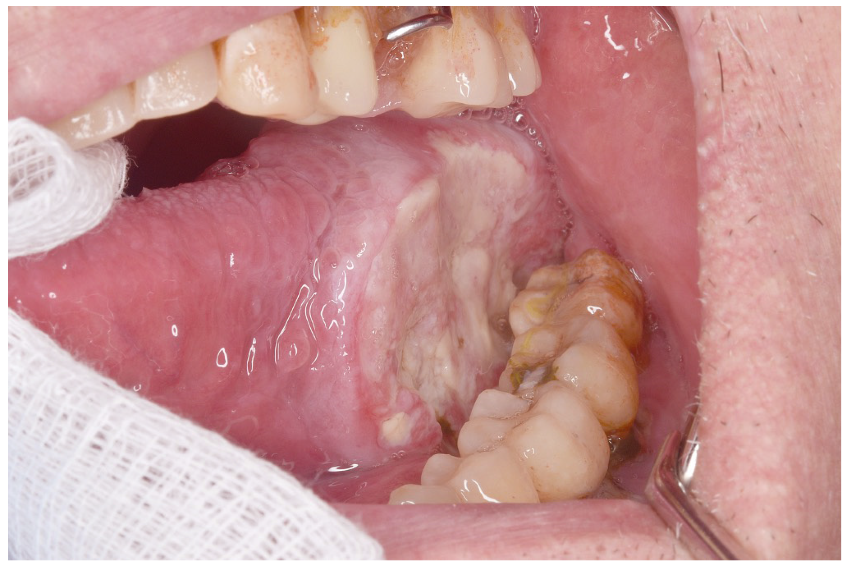 Cancers 17 01199 g002