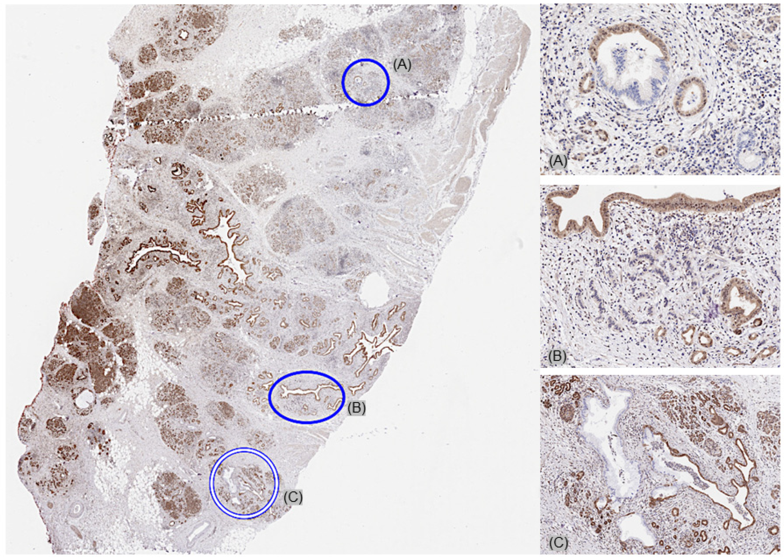 Cancers 17 01205 g003