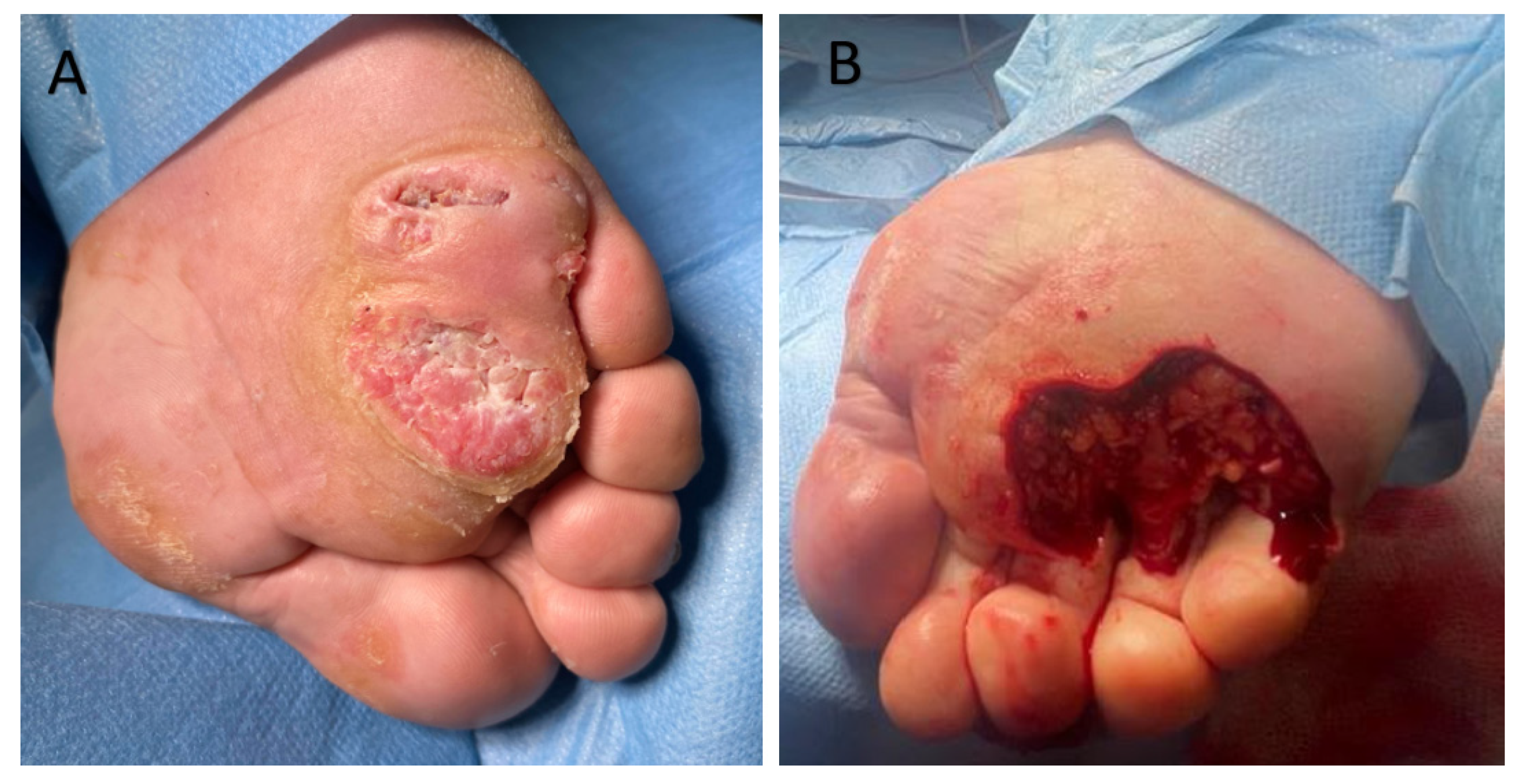 Cancers 17 01217 g004