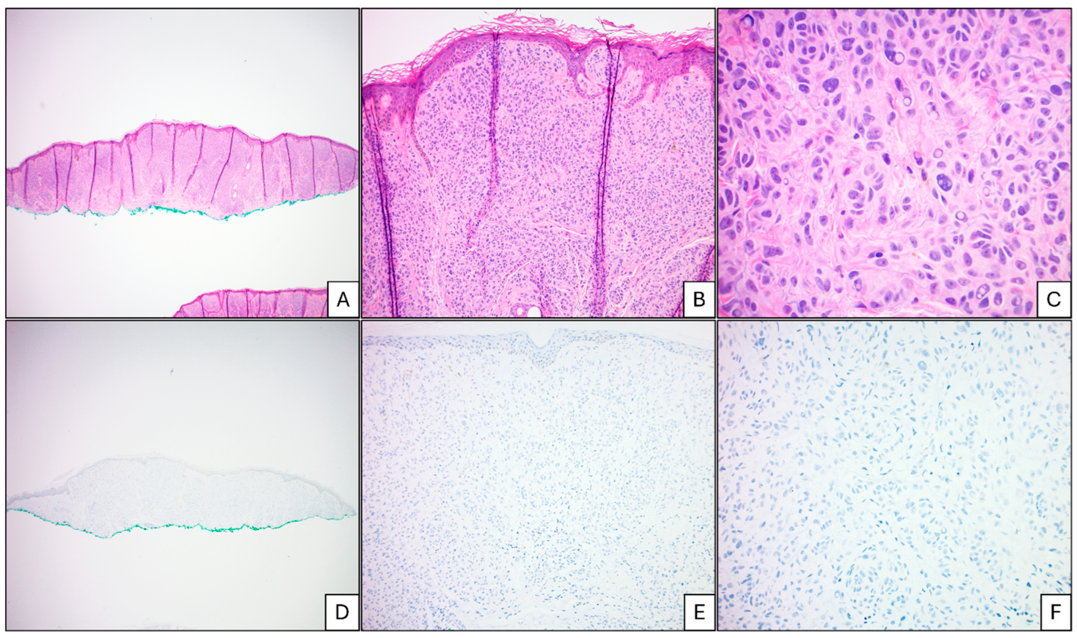 Cancers 17 01218 g002