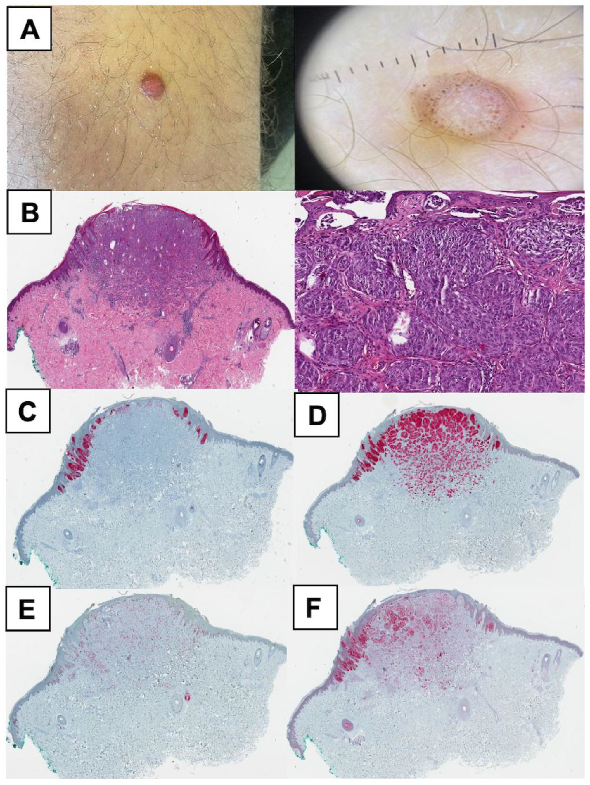 Cancers 17 01227 g003