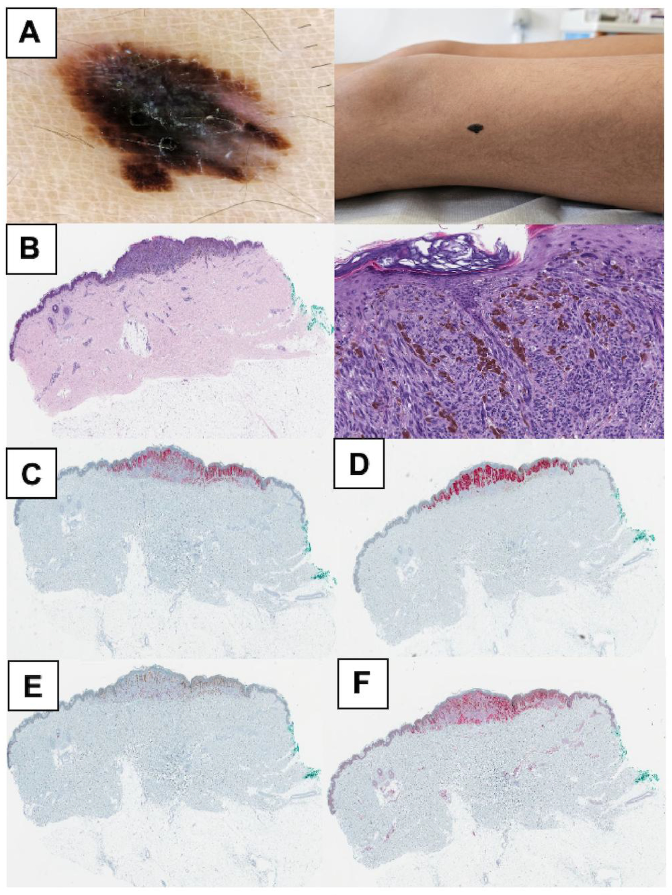 Cancers 17 01227 g004