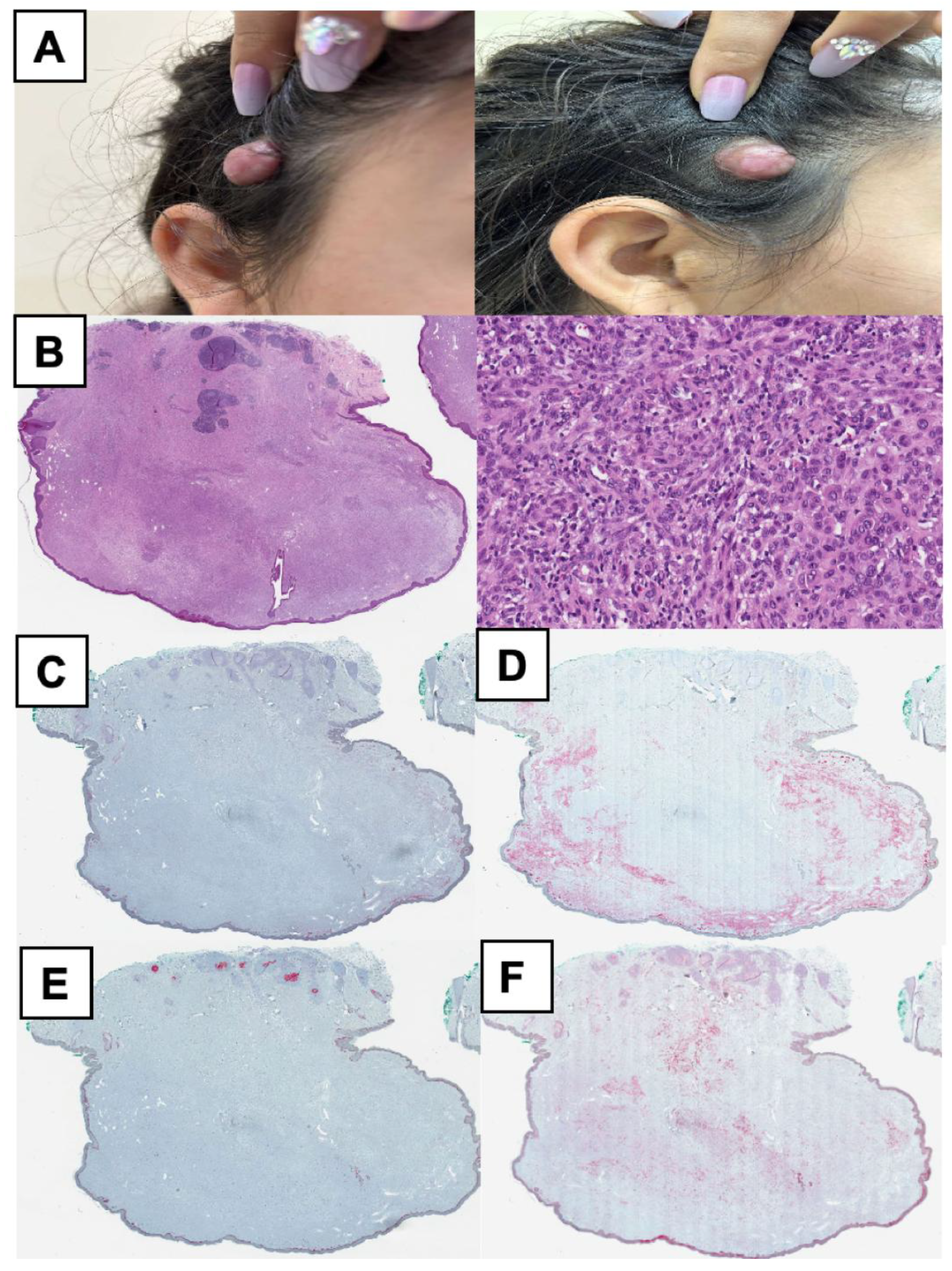 Cancers 17 01227 g005