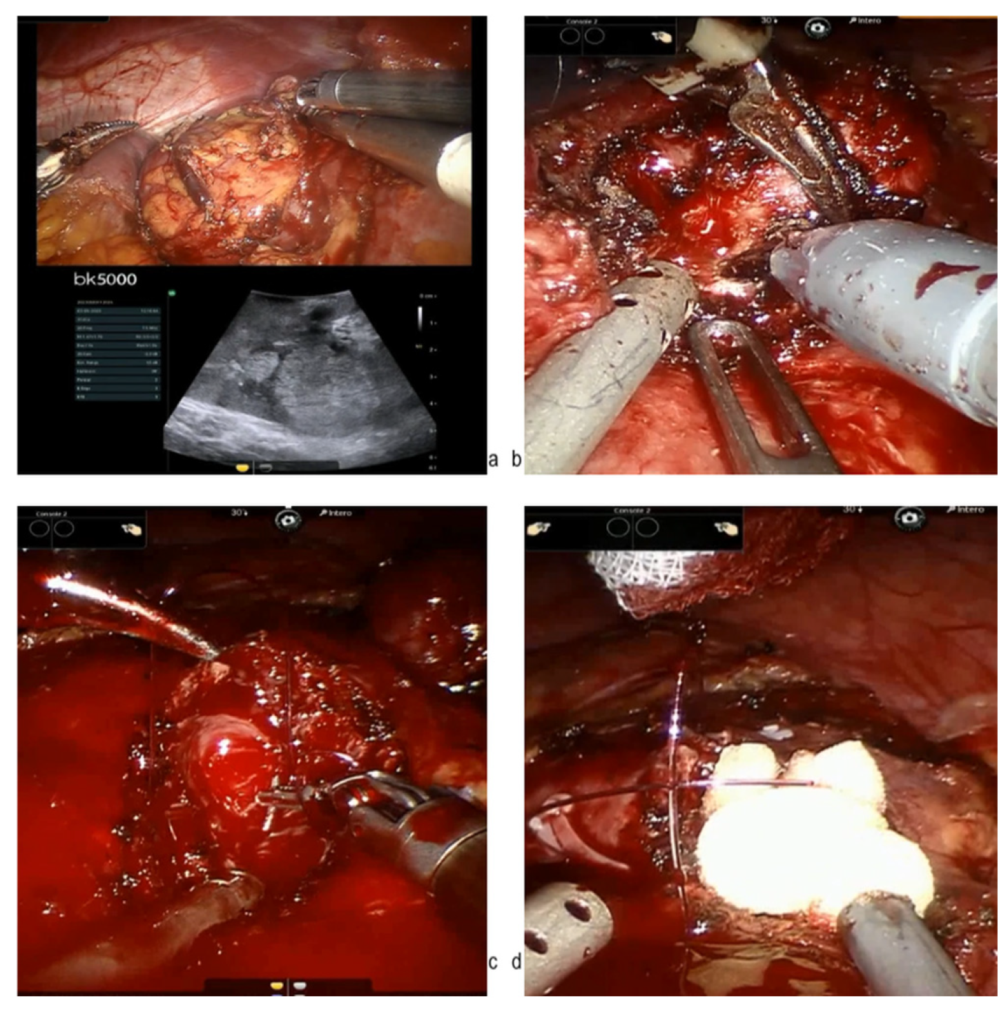 Cancers 17 01236 g002