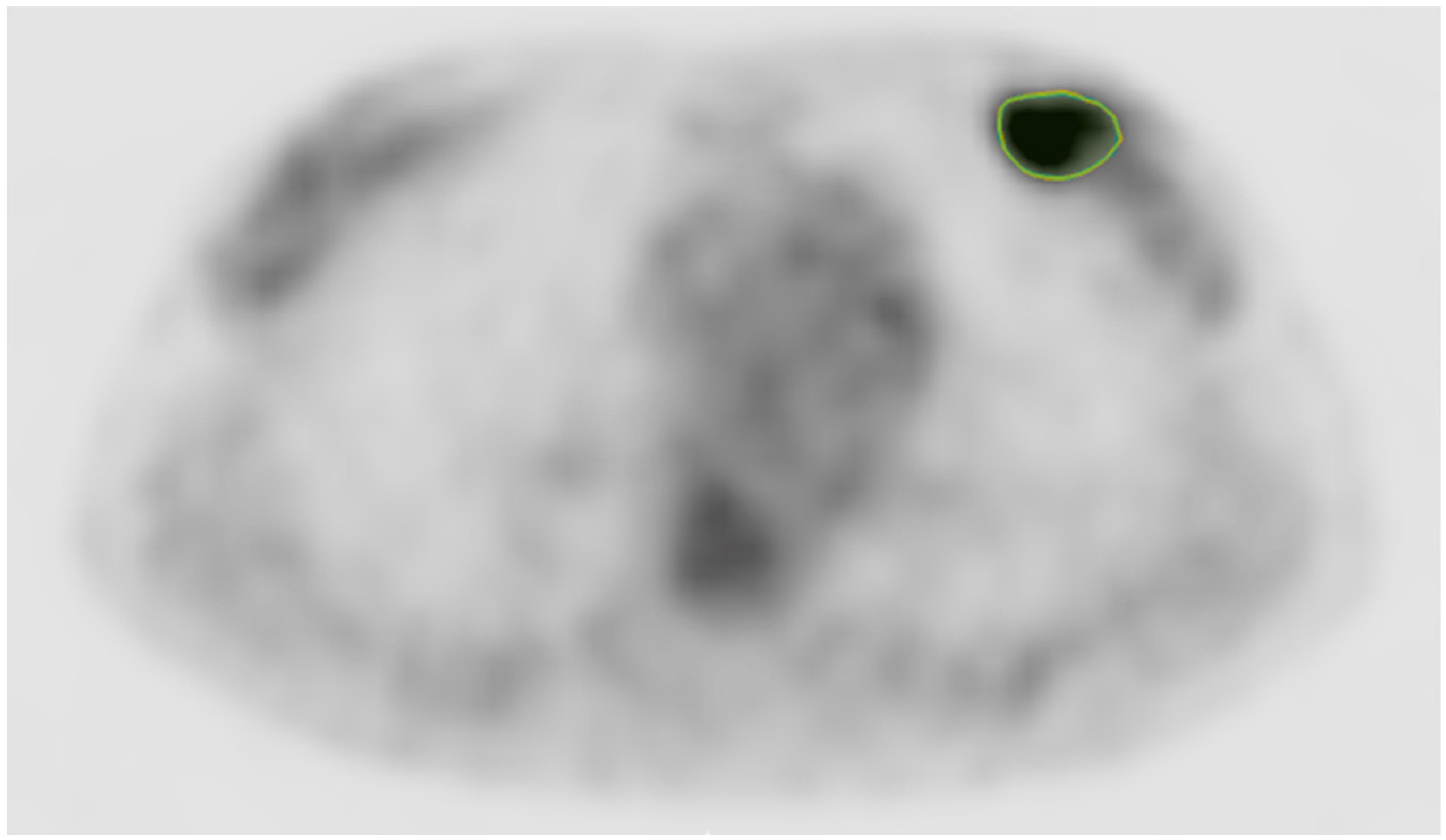 Cancers 17 01249 g001