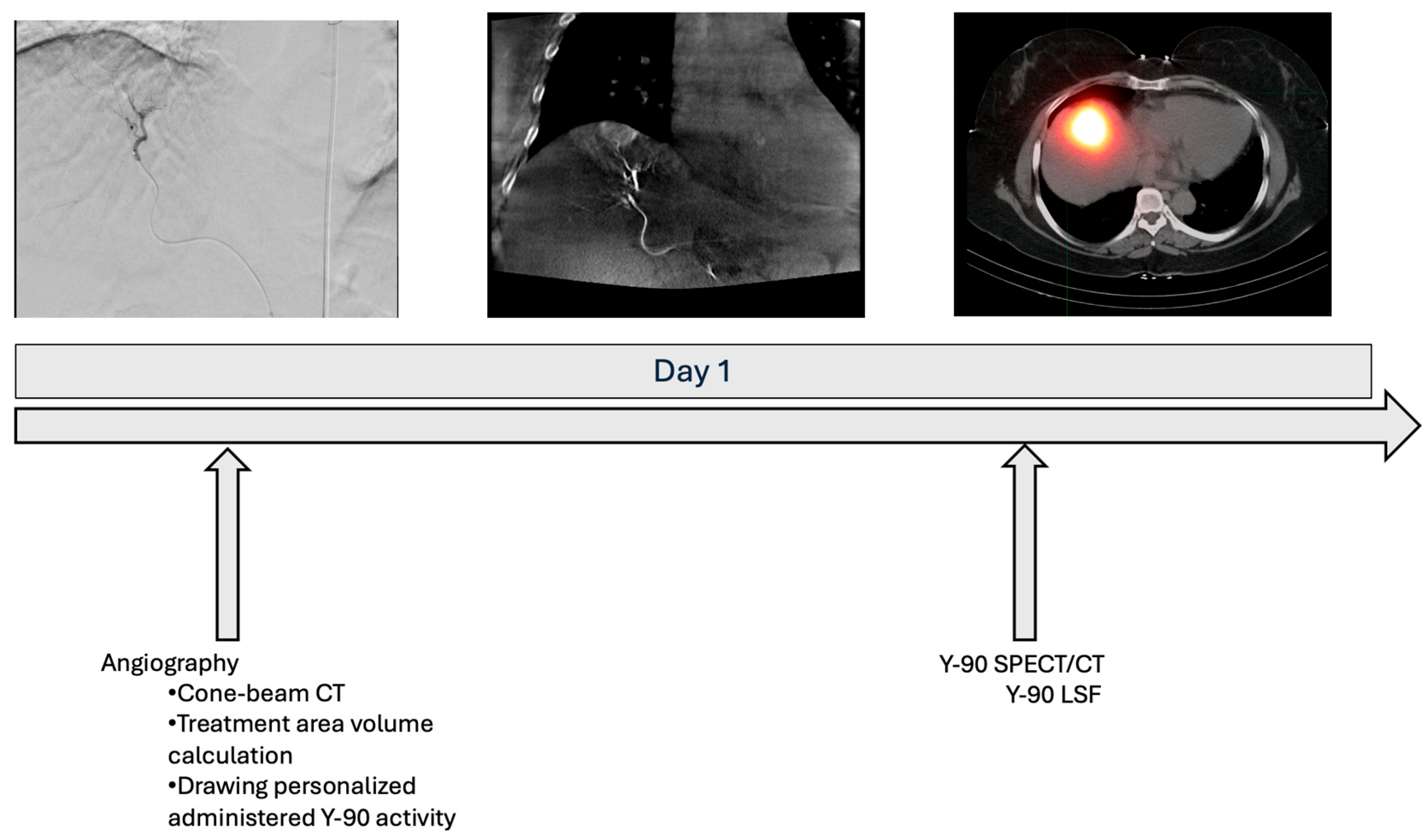 Cancers 17 01265 g001b