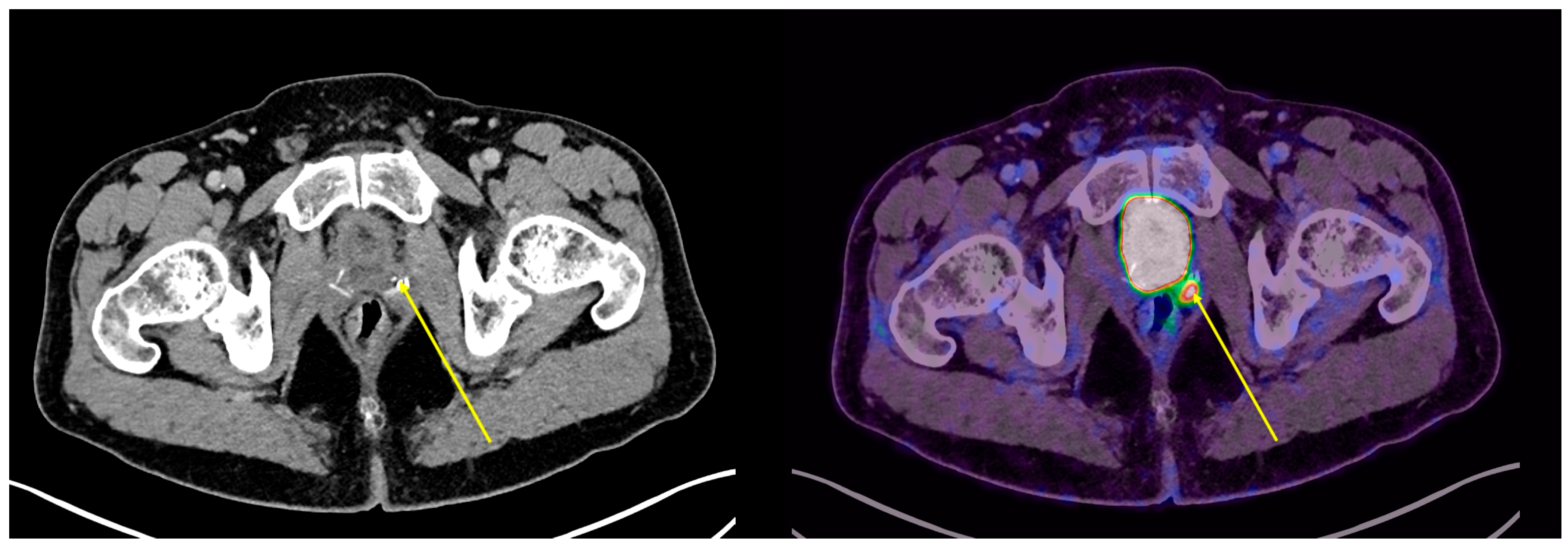 Cancers 17 01272 g003