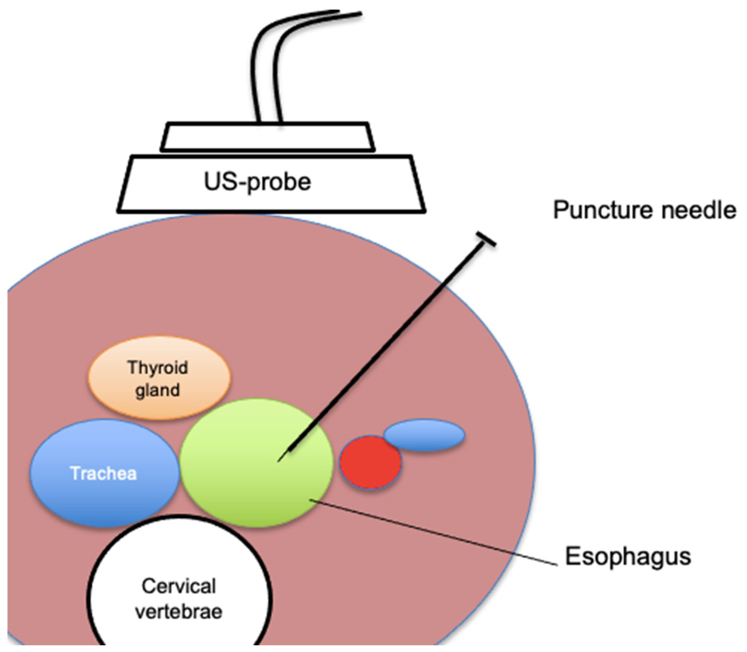 Cancers 17 01287 g001