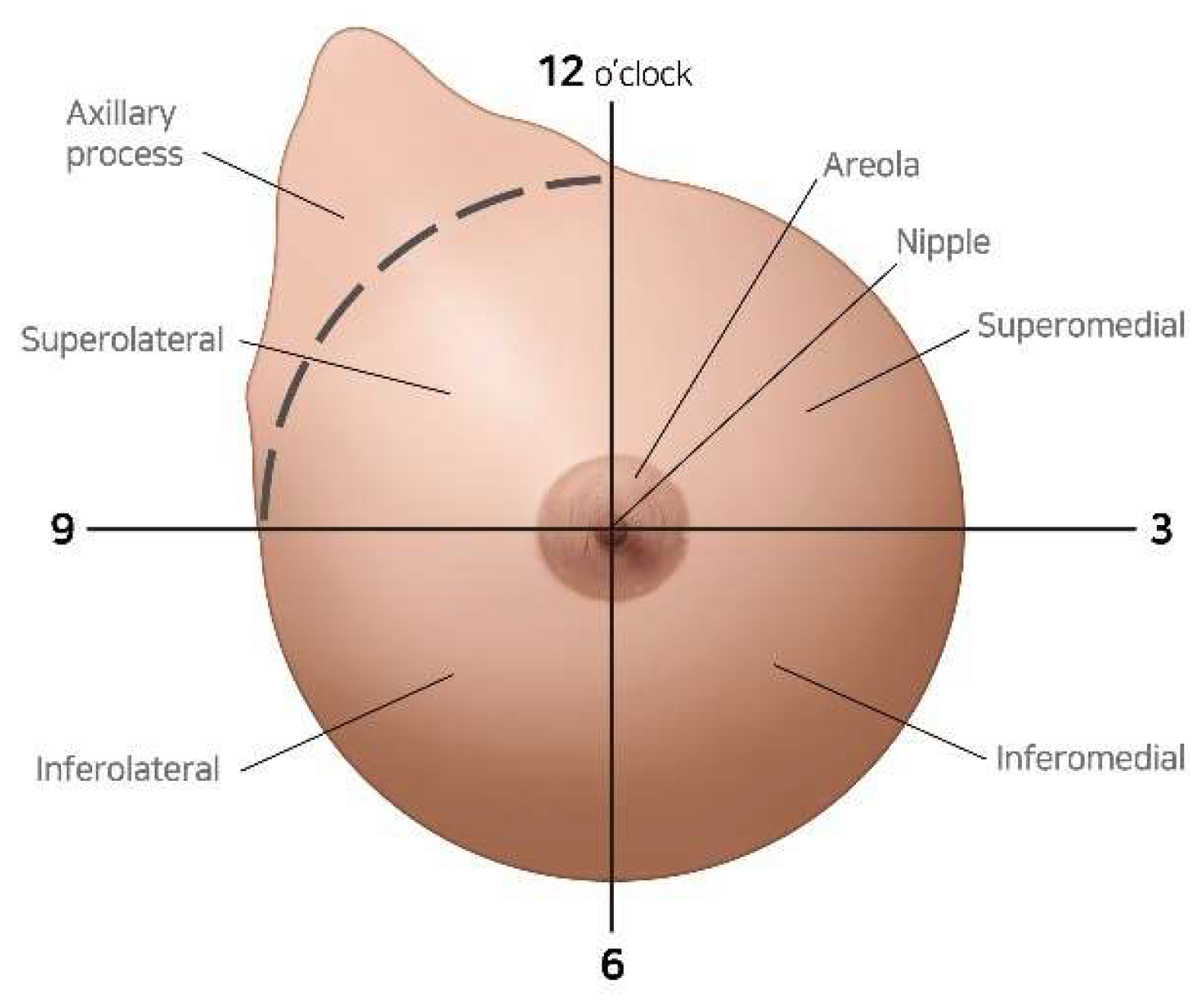Cancers 17 01293 g002