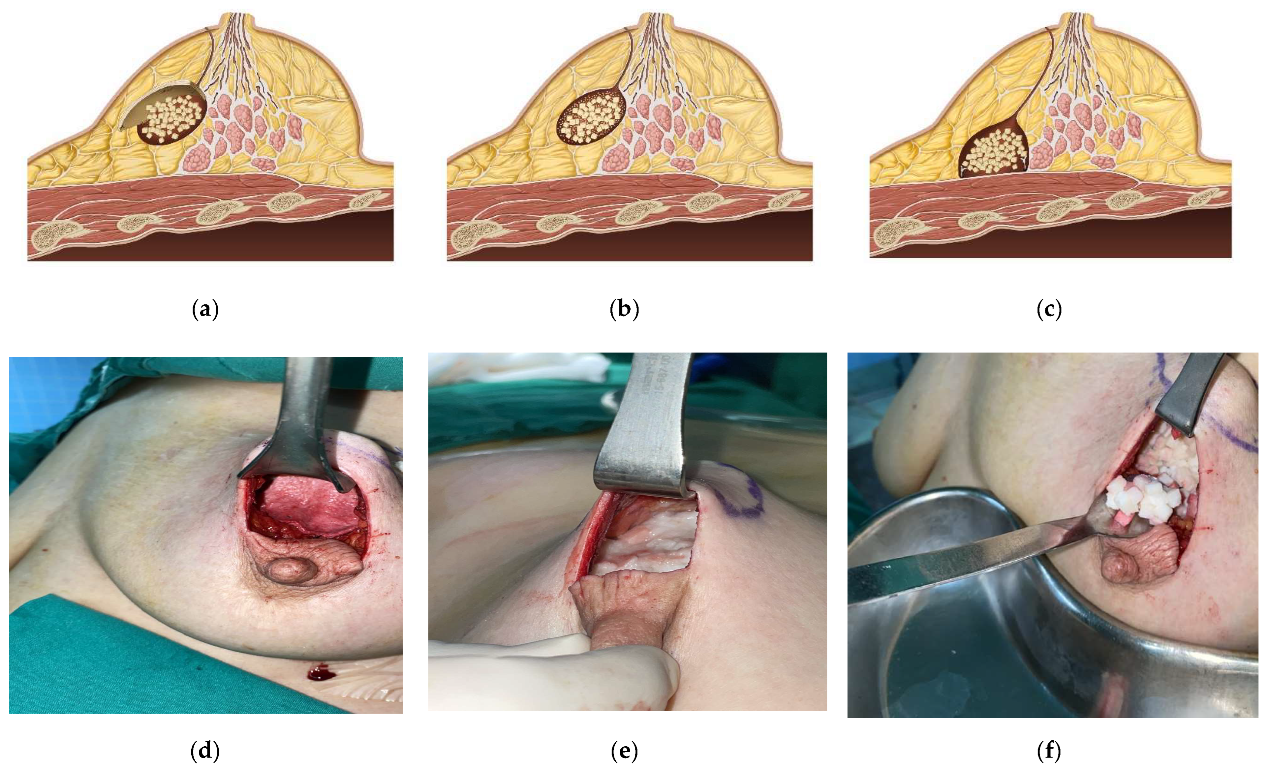 Cancers 17 01293 g003