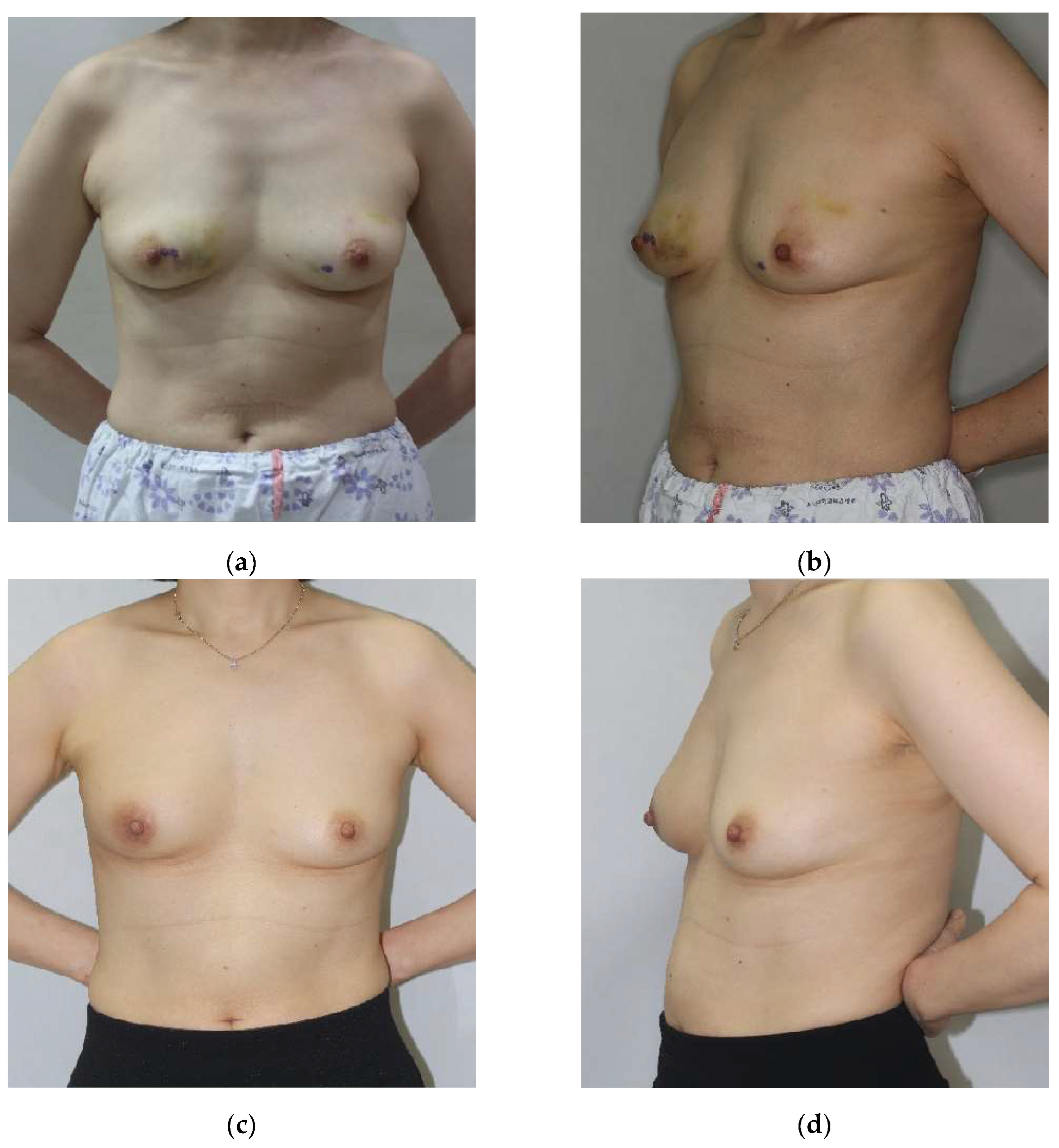 Cancers 17 01293 g004