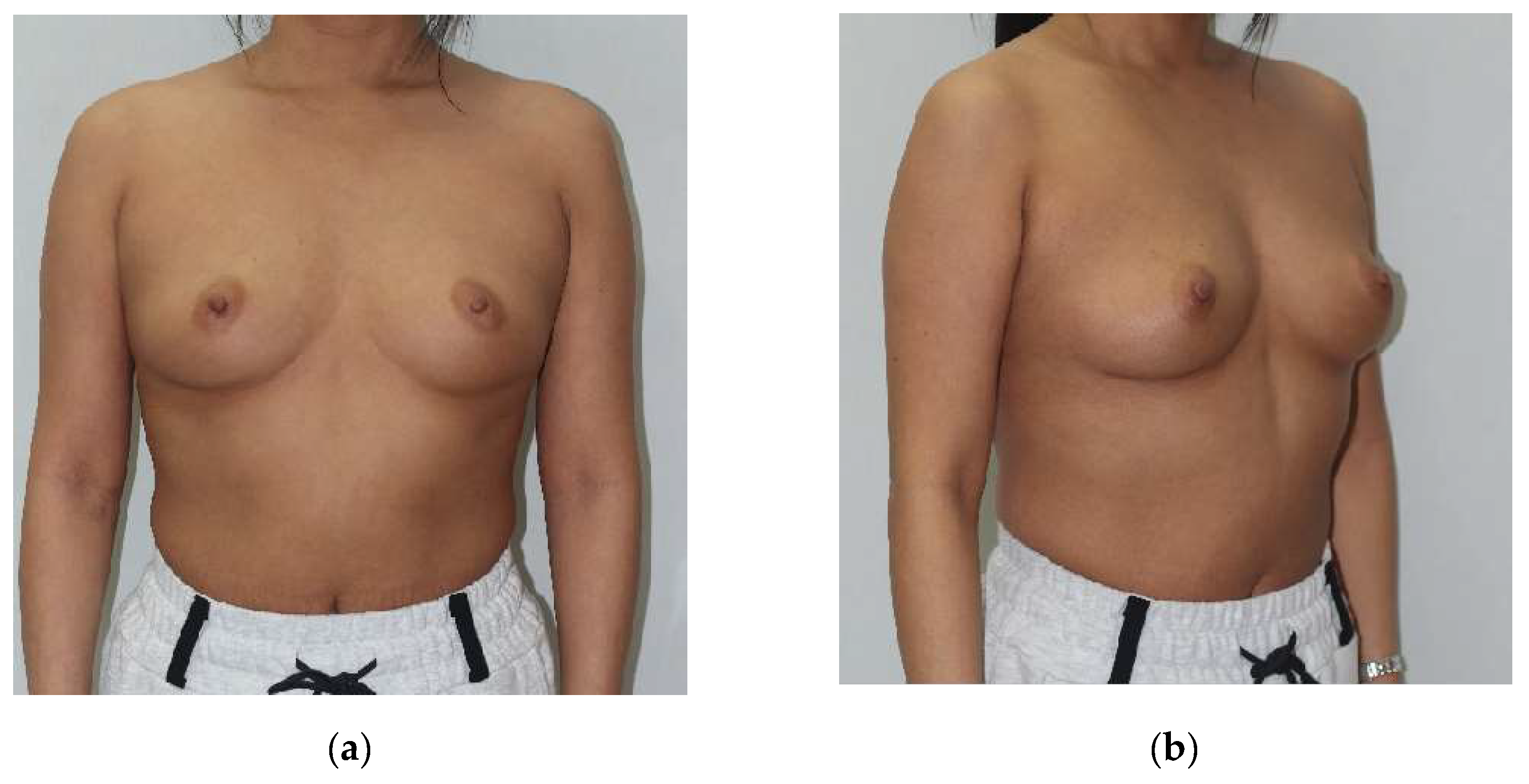 Cancers 17 01293 g005a