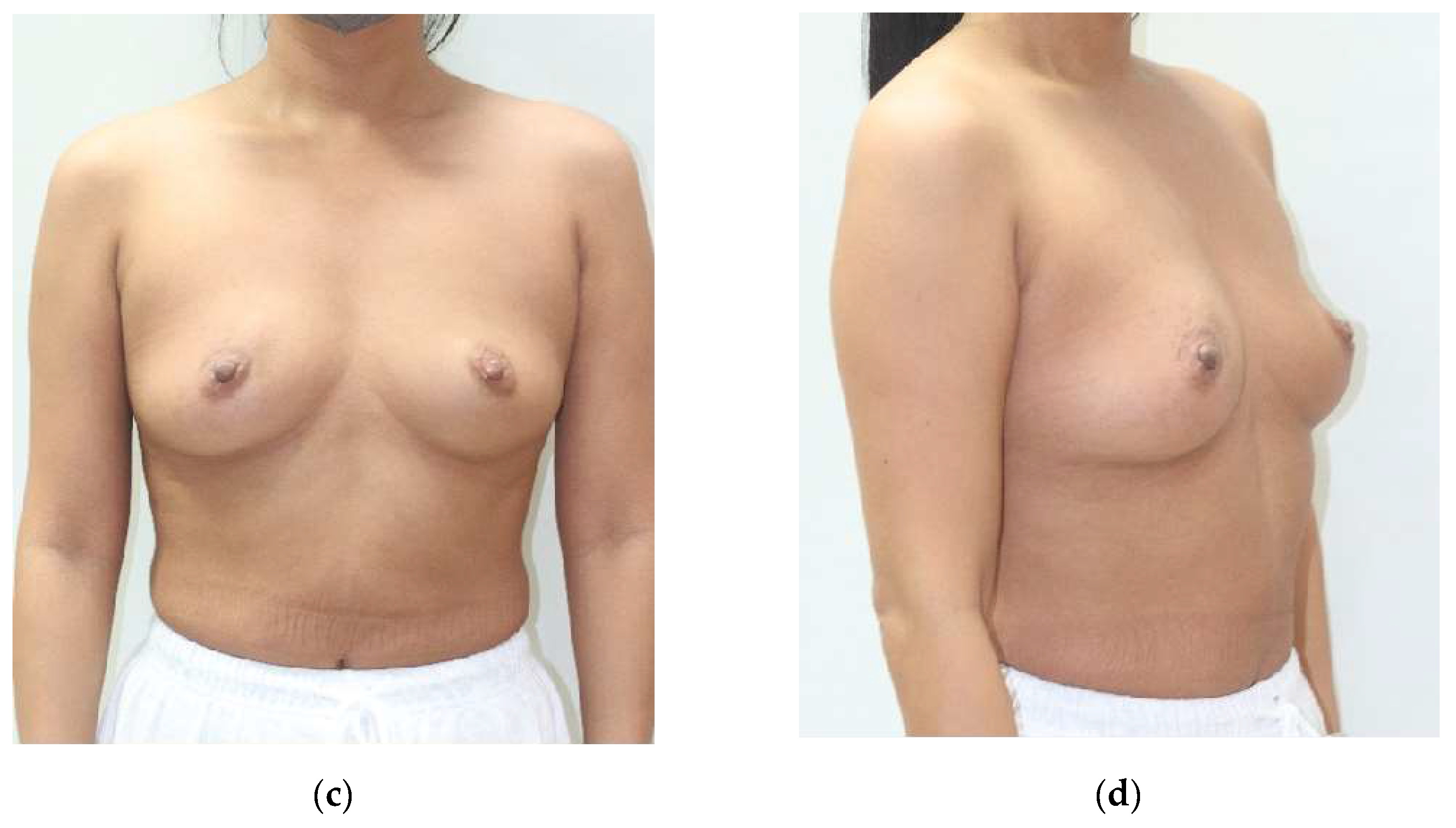 Cancers 17 01293 g005b