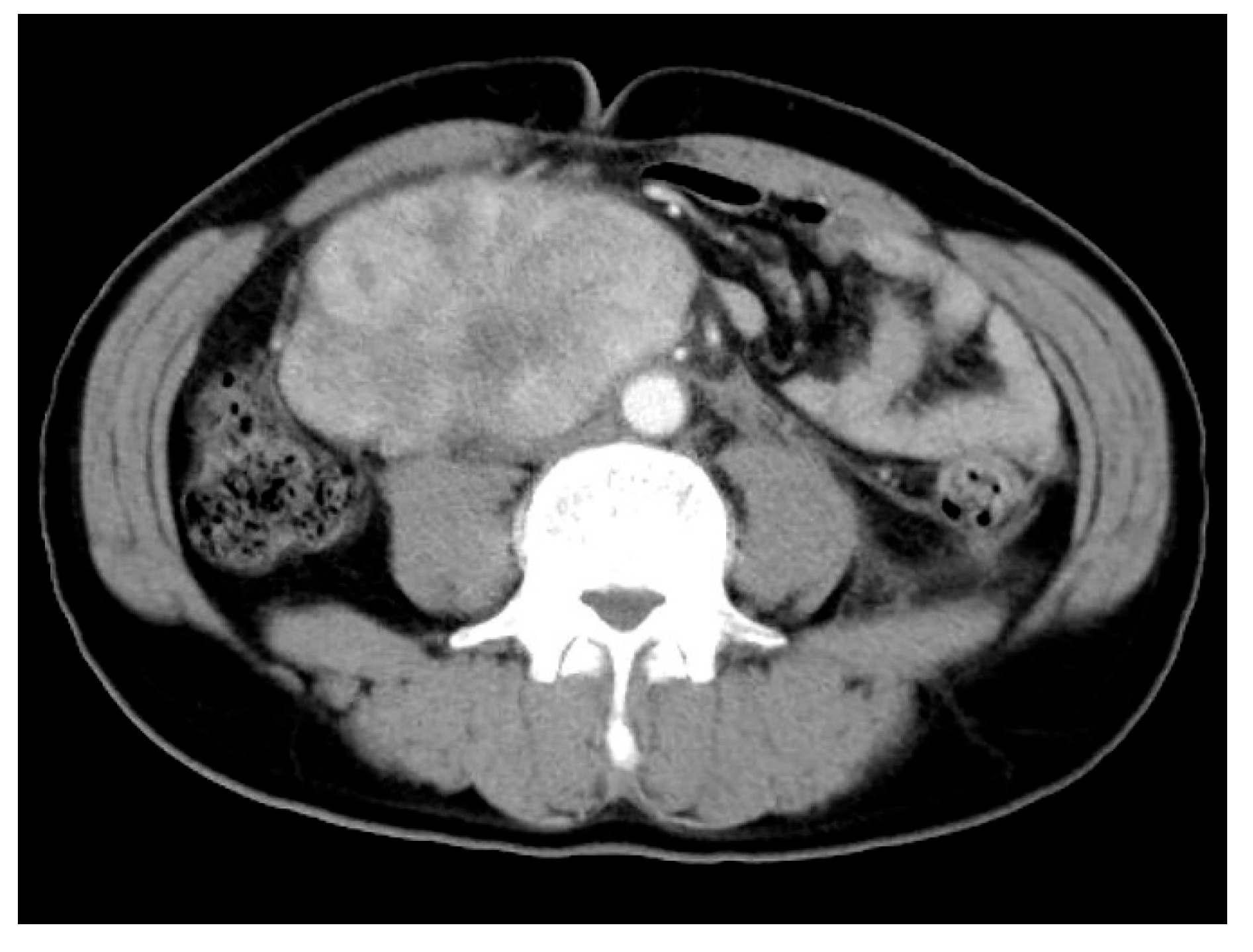 Cancers 17 01327 g001