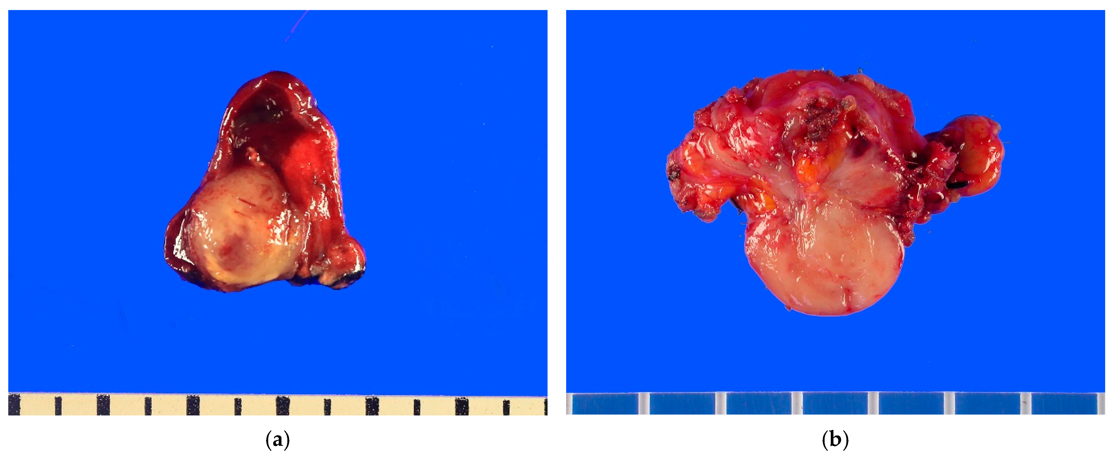 Cancers 17 01327 g002