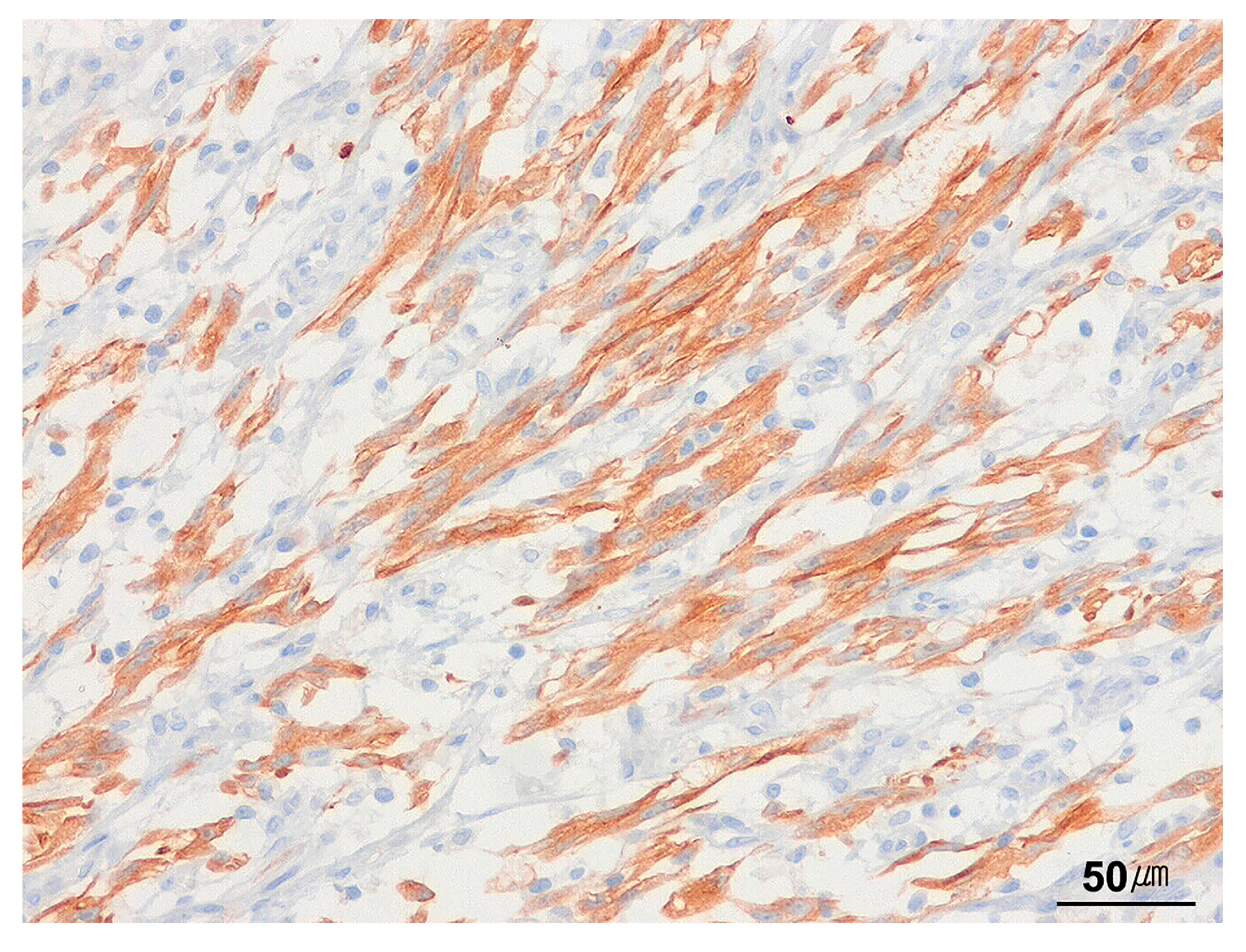 Cancers 17 01327 g004