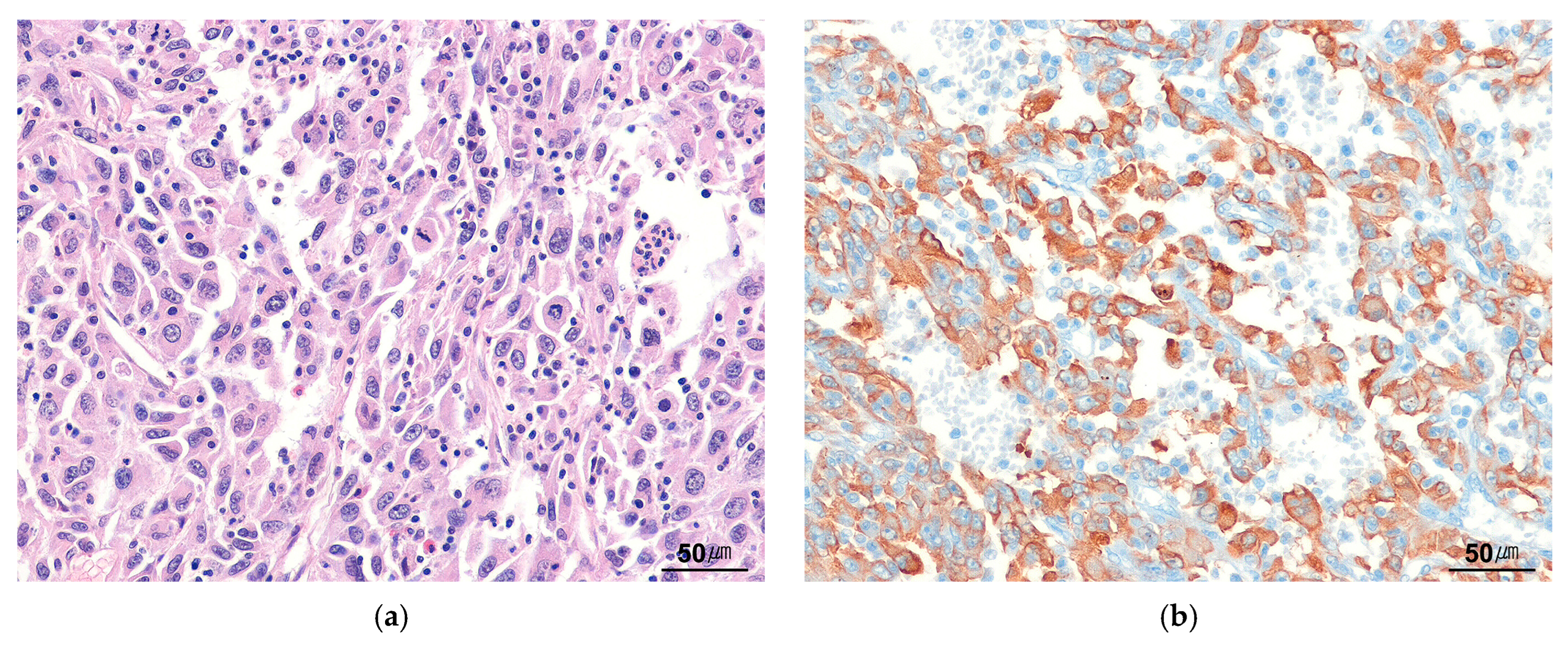 Cancers 17 01327 g005