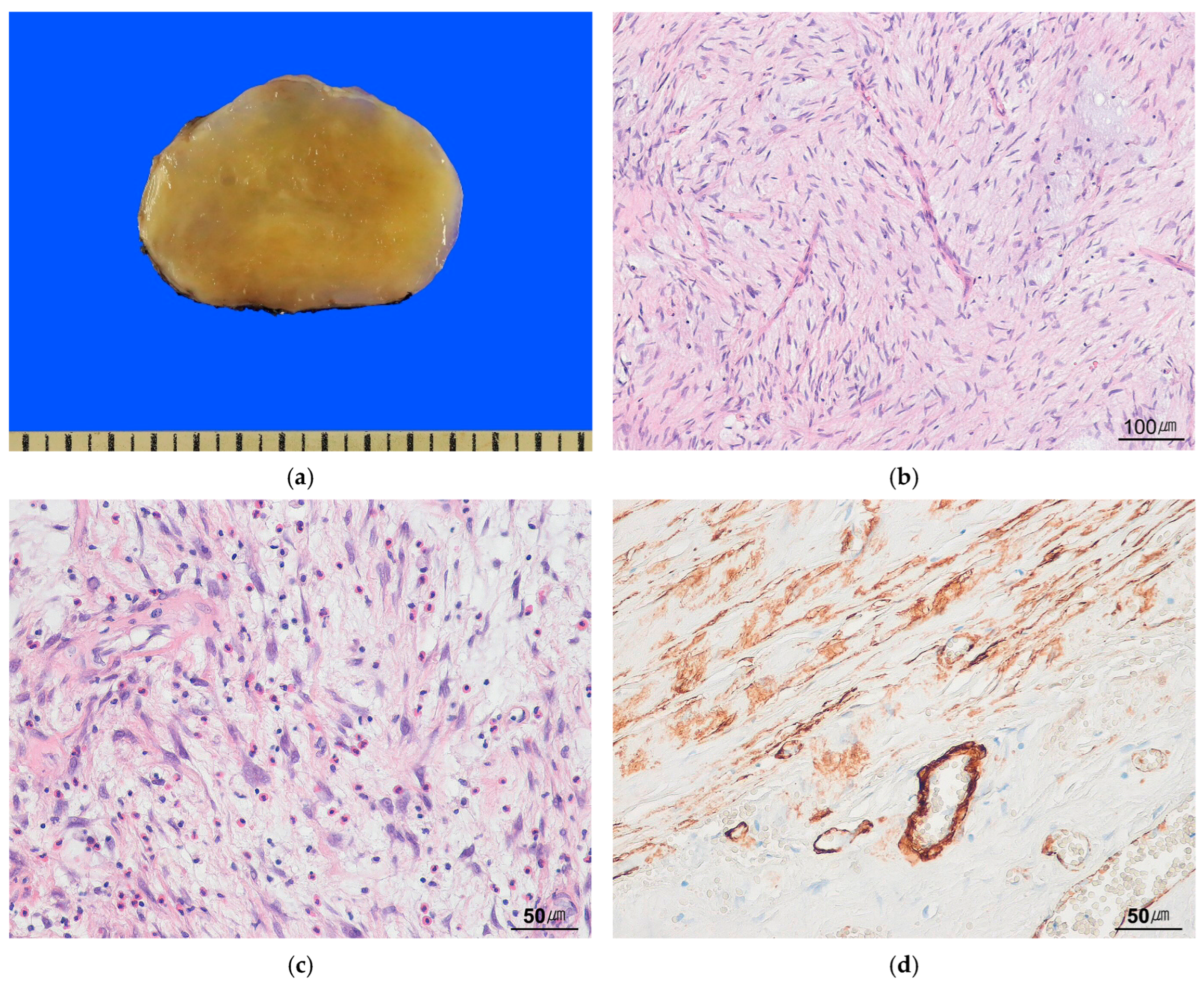 Cancers 17 01327 g006