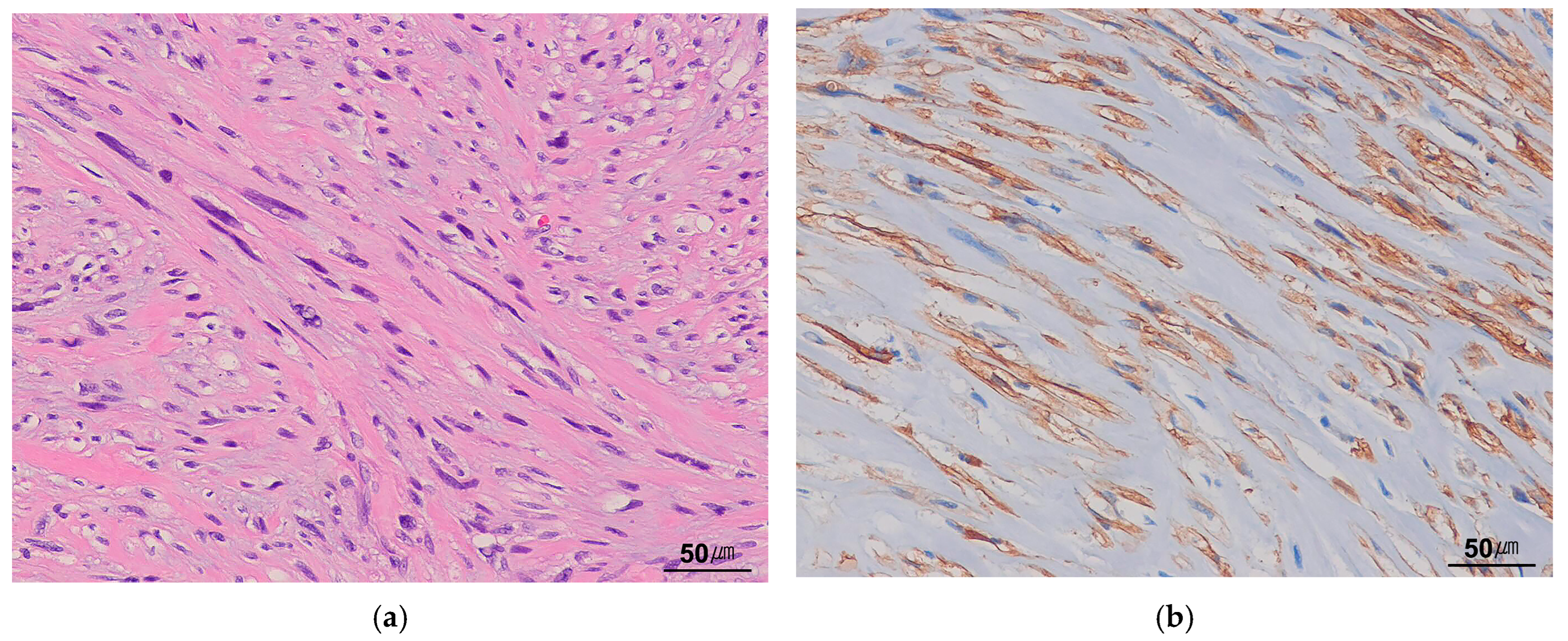 Cancers 17 01327 g009