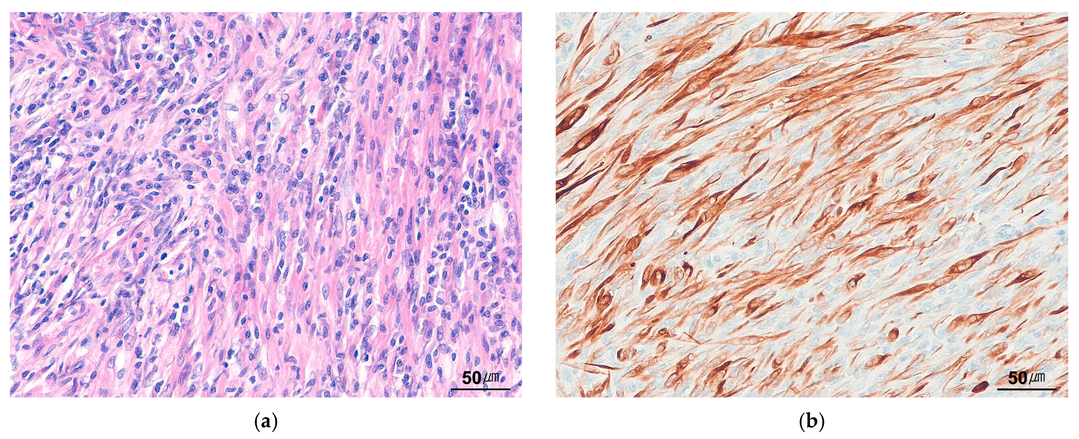 Cancers 17 01327 g011