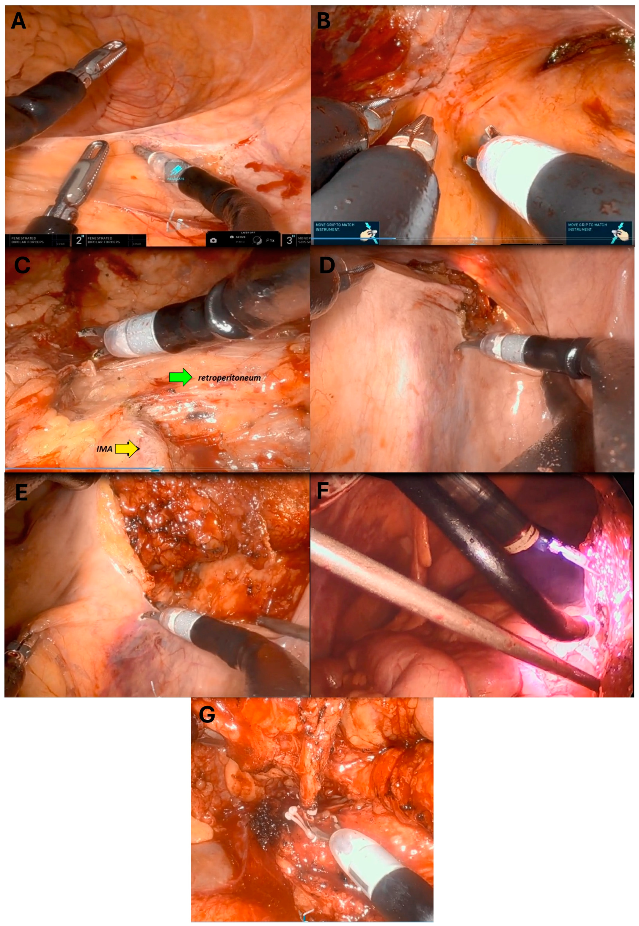 Cancers 17 01328 g003