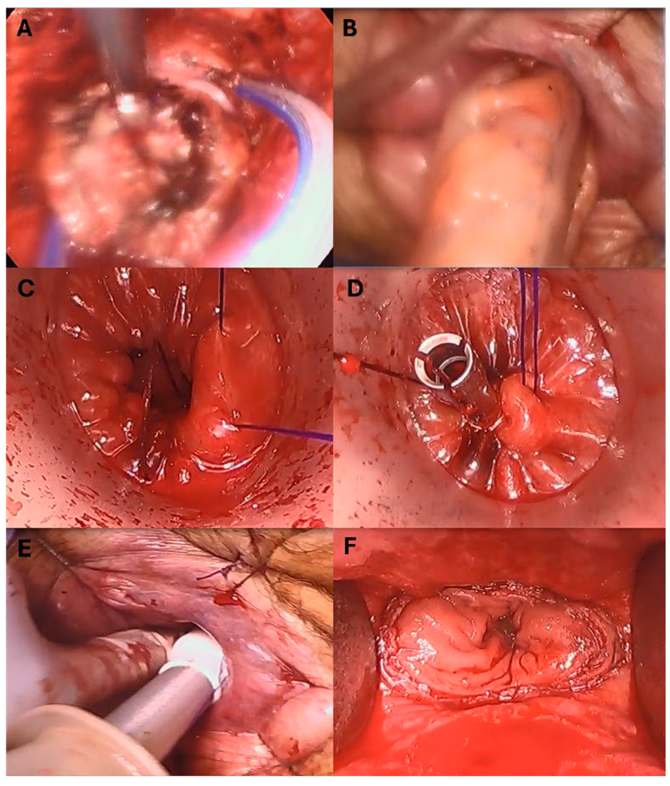 Cancers 17 01328 g004