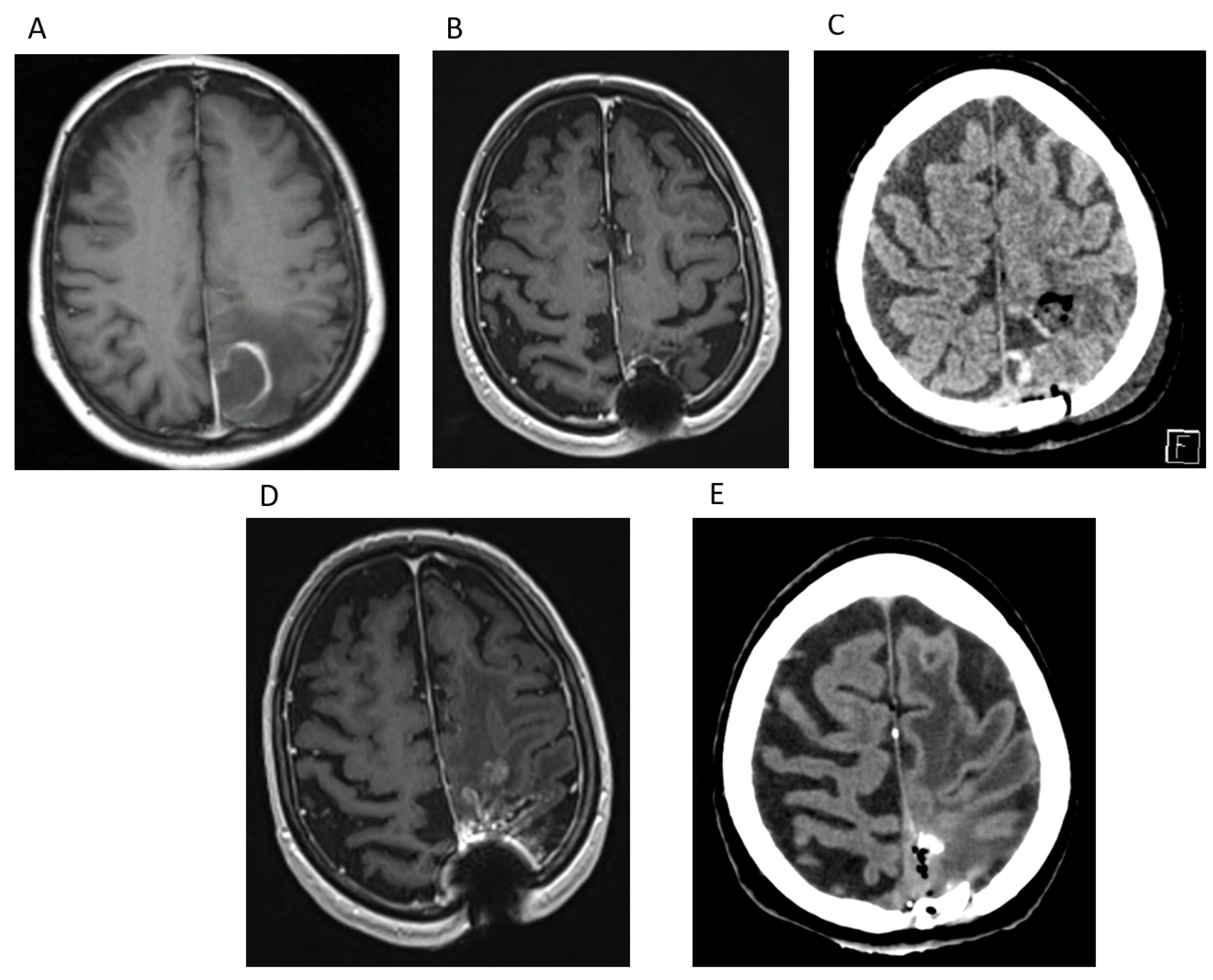 Cancers 17 01348 g007